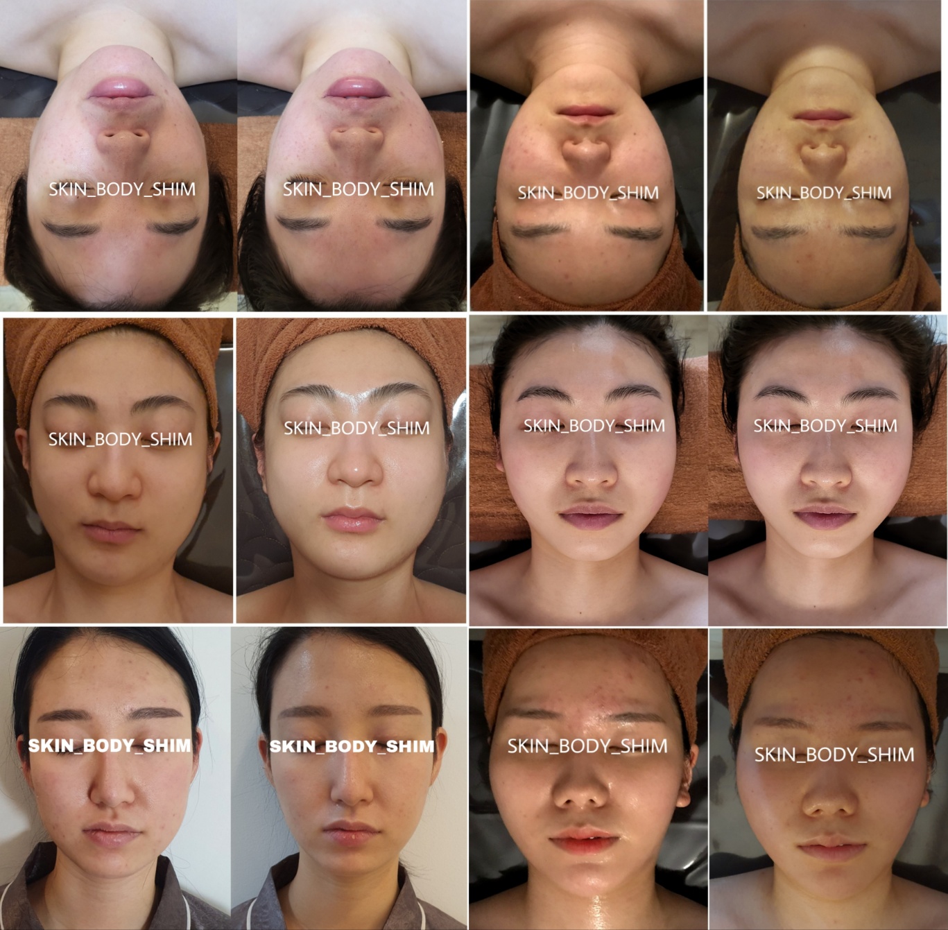 스킨앤바디 쉼