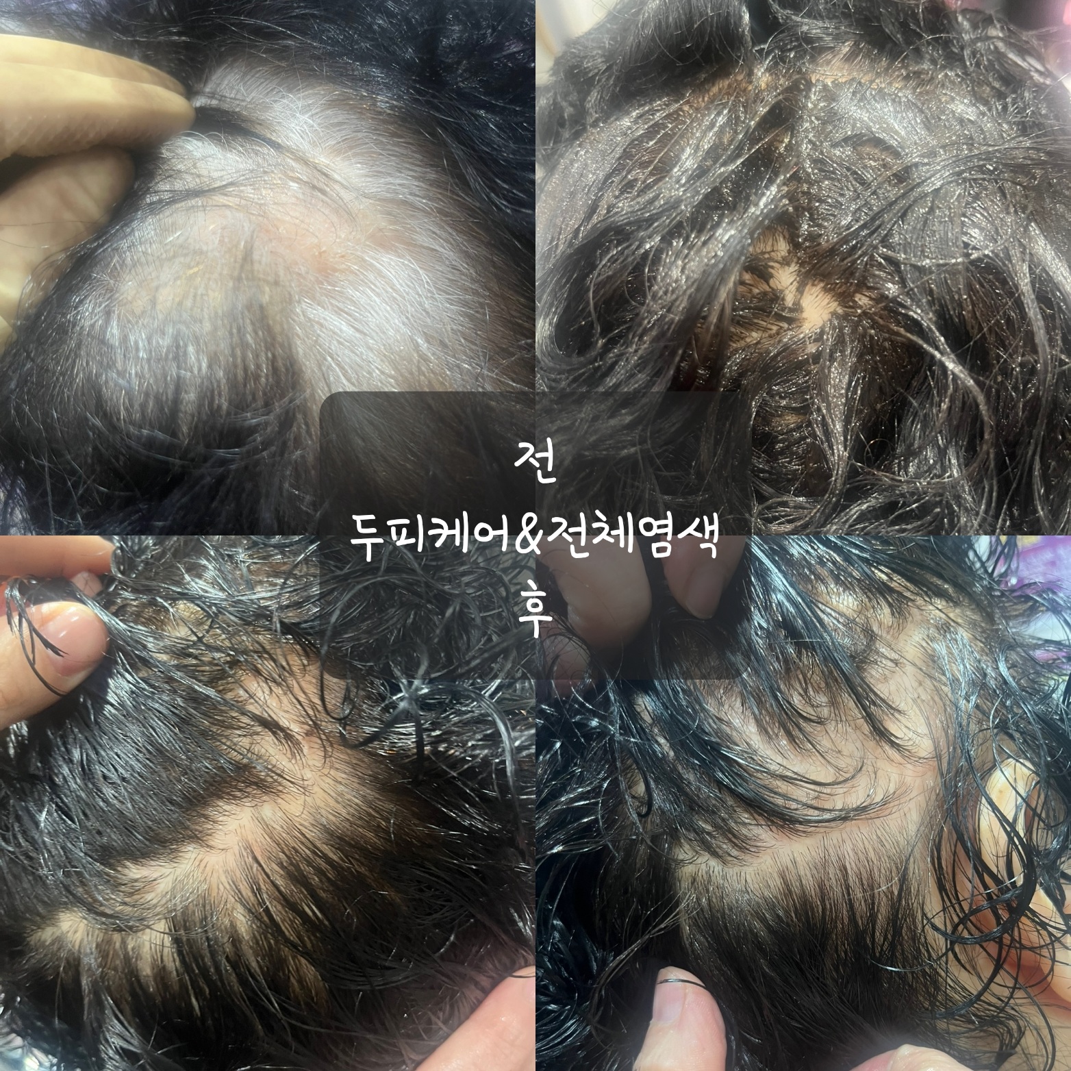 수앤큐사랑 염색 피부관리 속눈썹 두피탈모