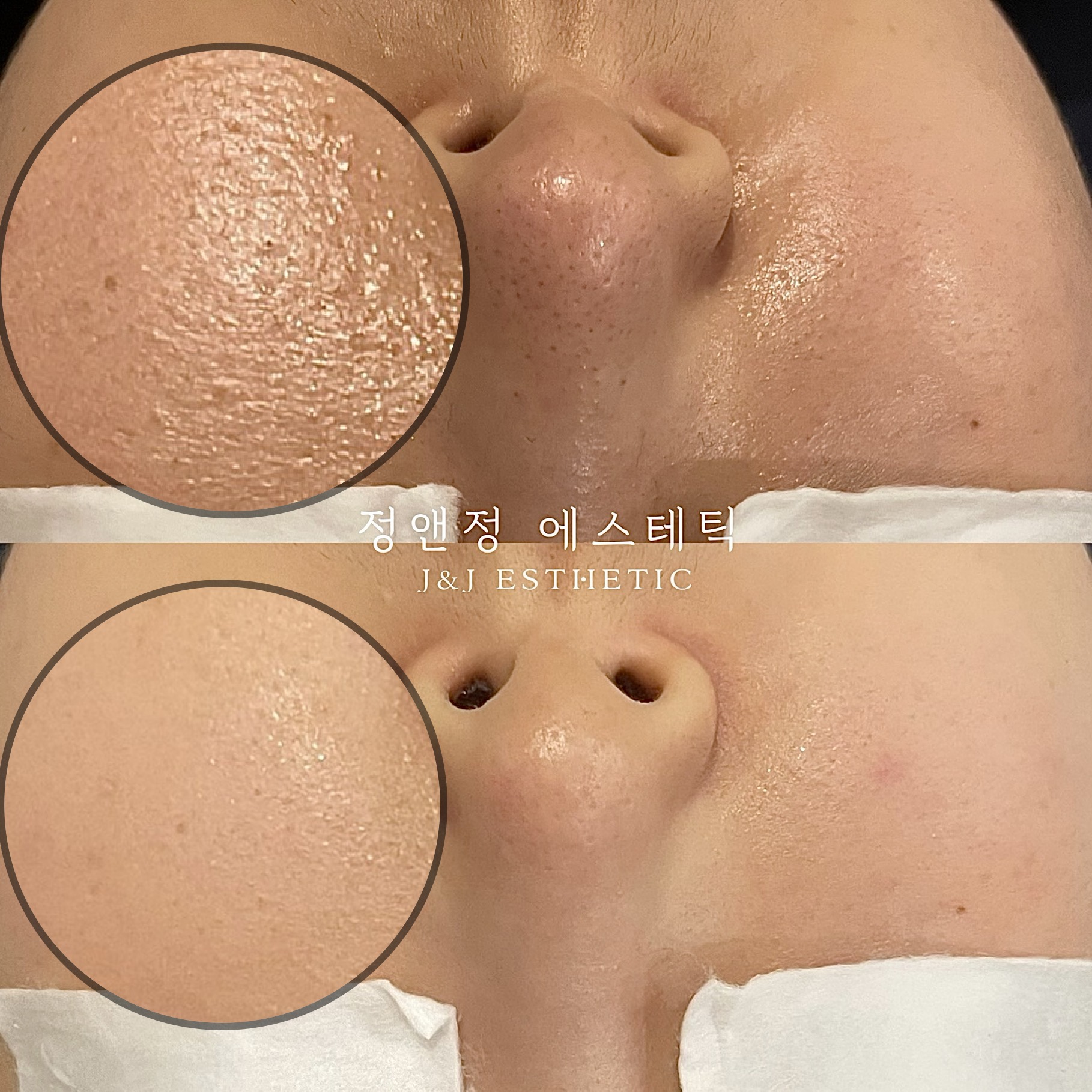 정앤정에스테틱
