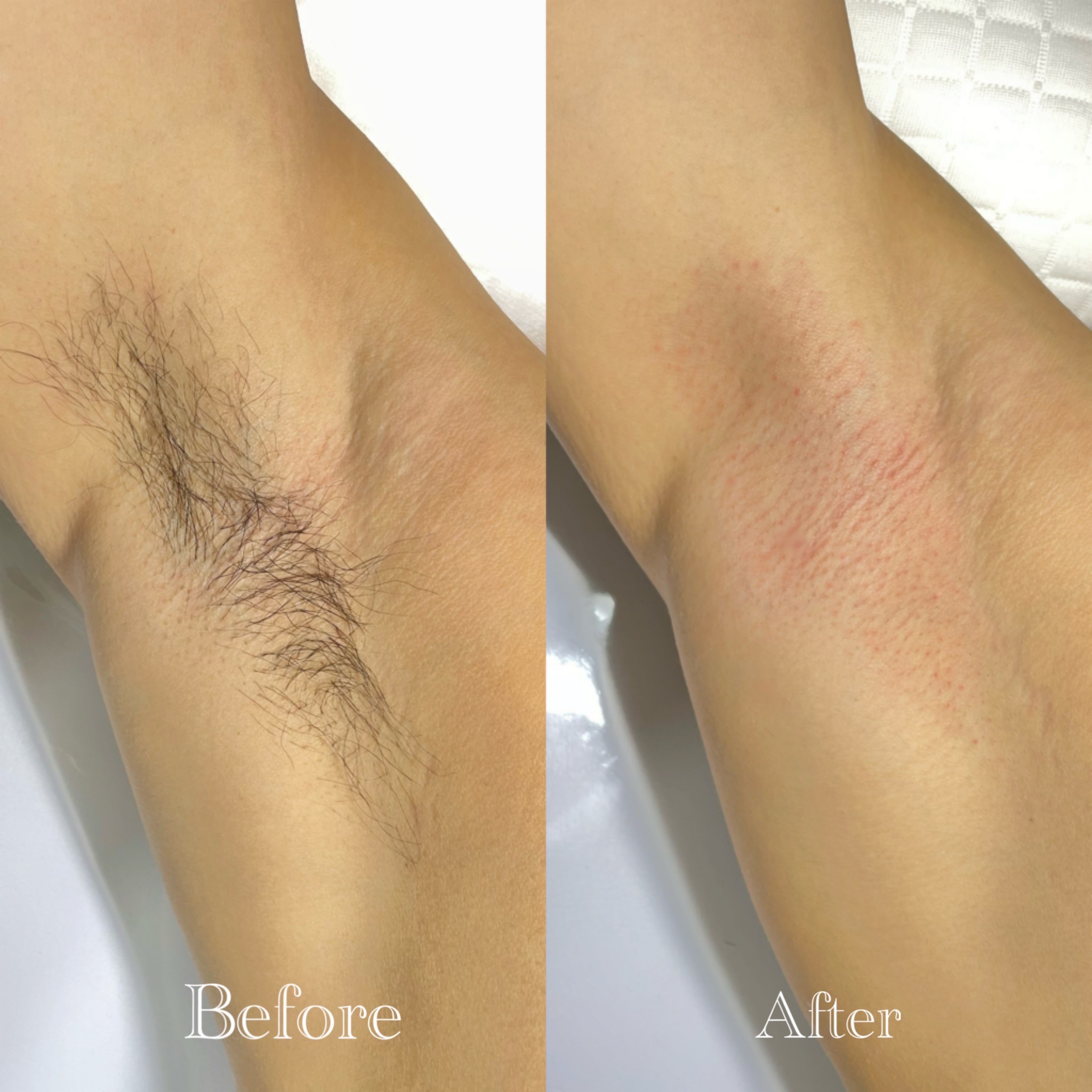 뽑아드림슈가링왁싱