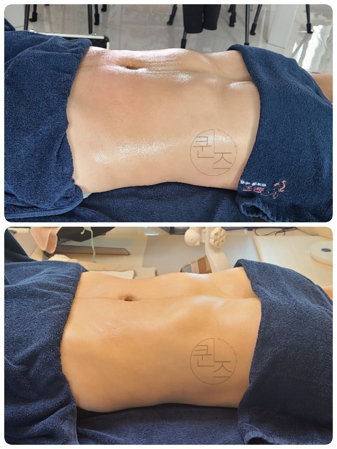 퀸즈산모케어 photo 8