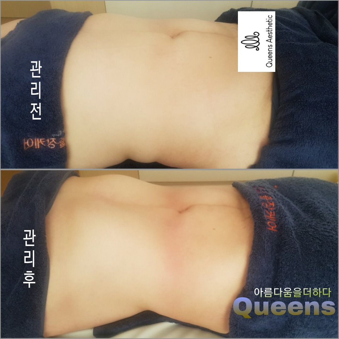 퀸즈산모케어 photo 7
