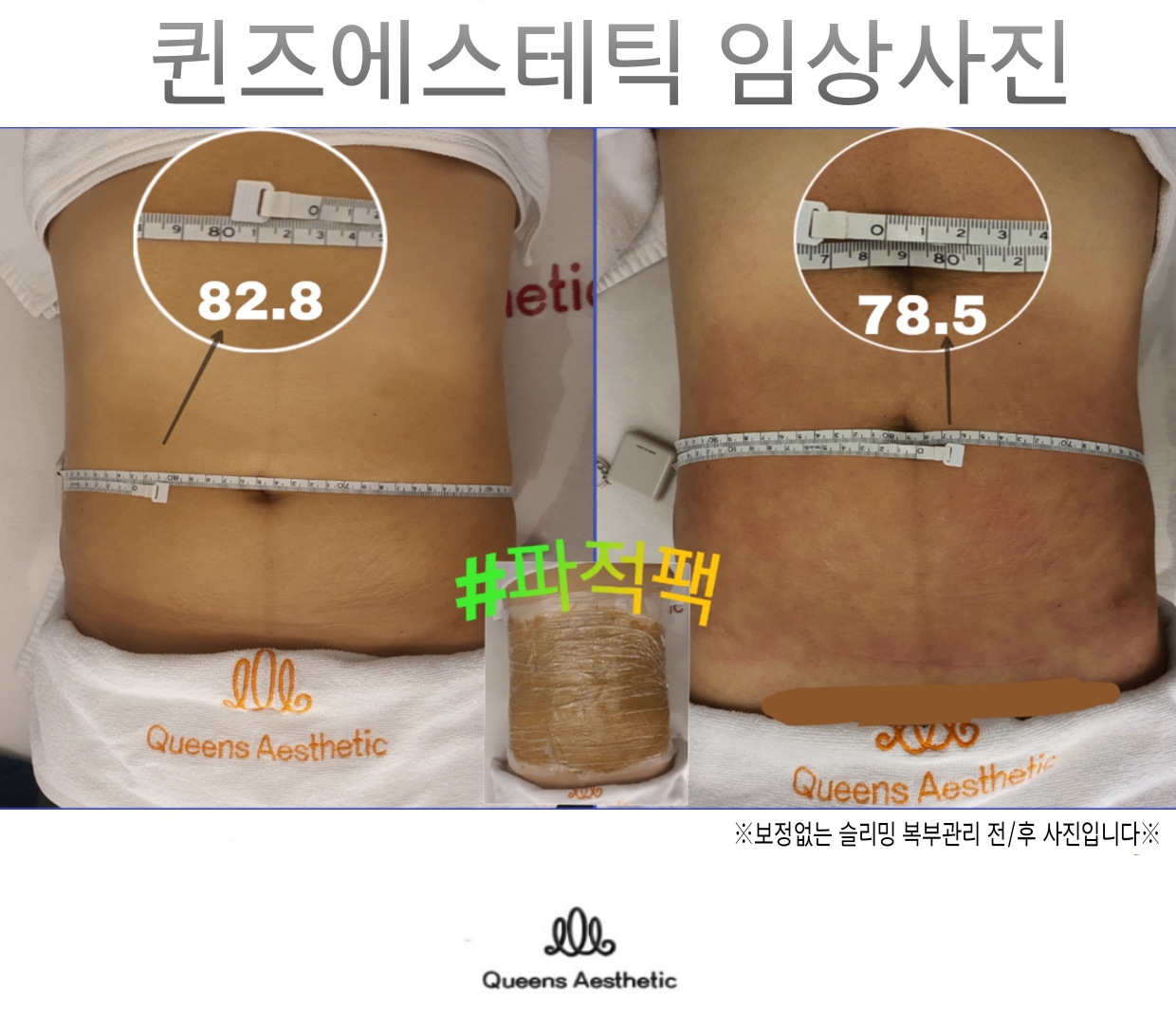 퀸즈산모케어