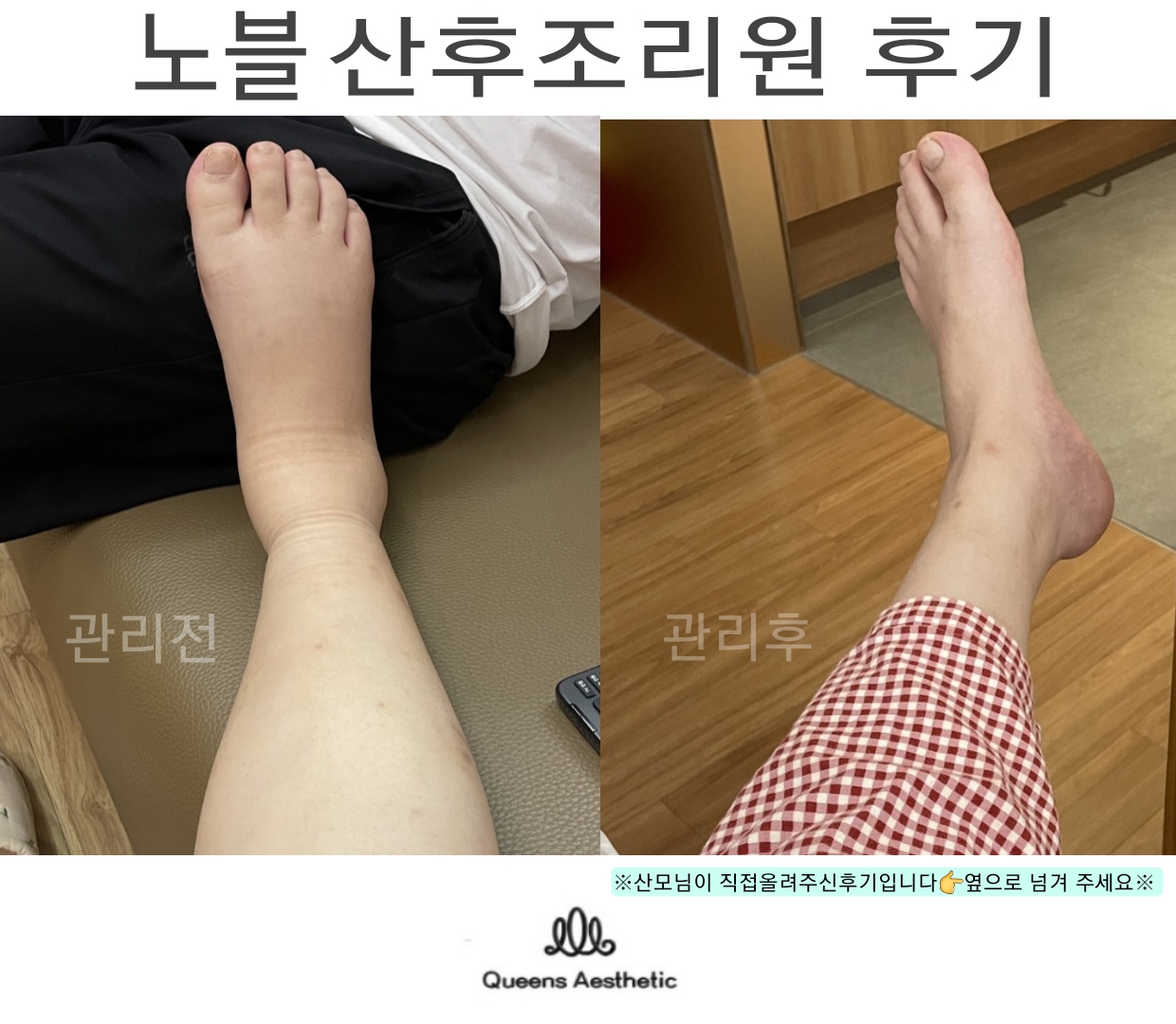 퀸즈산모케어