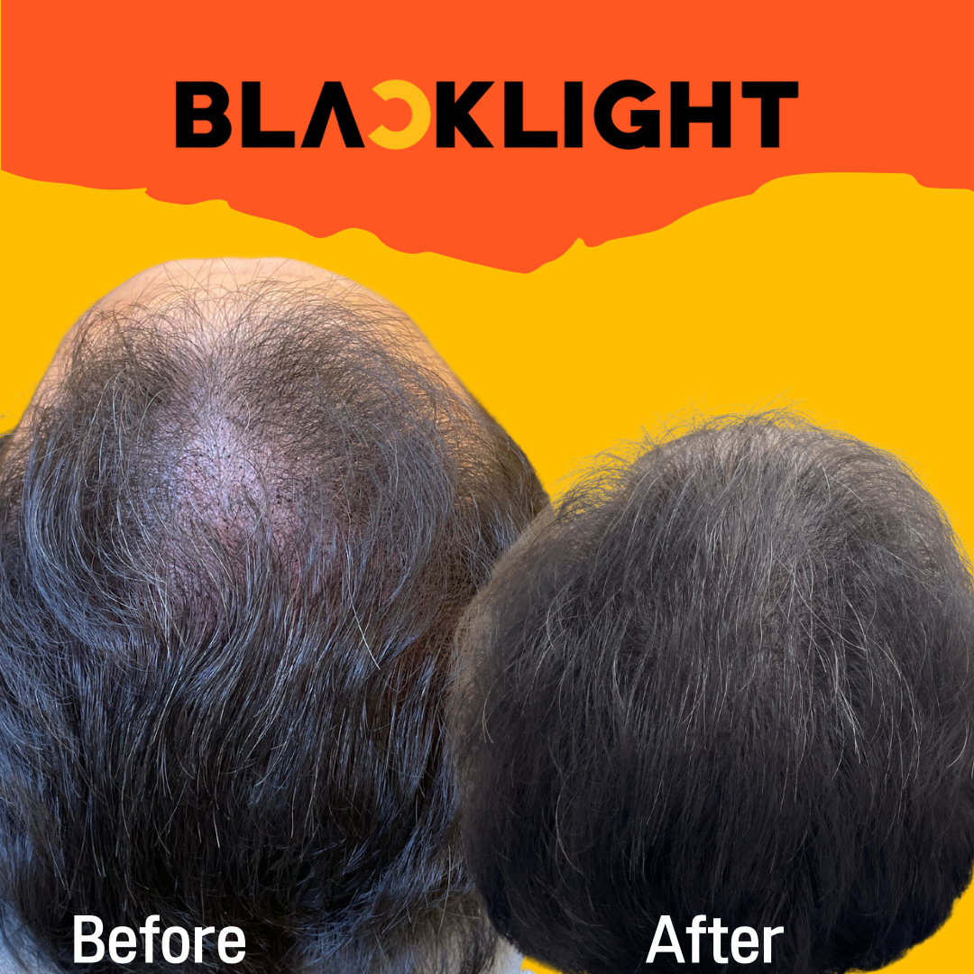 블랙라이트 SMP 대표 이미지