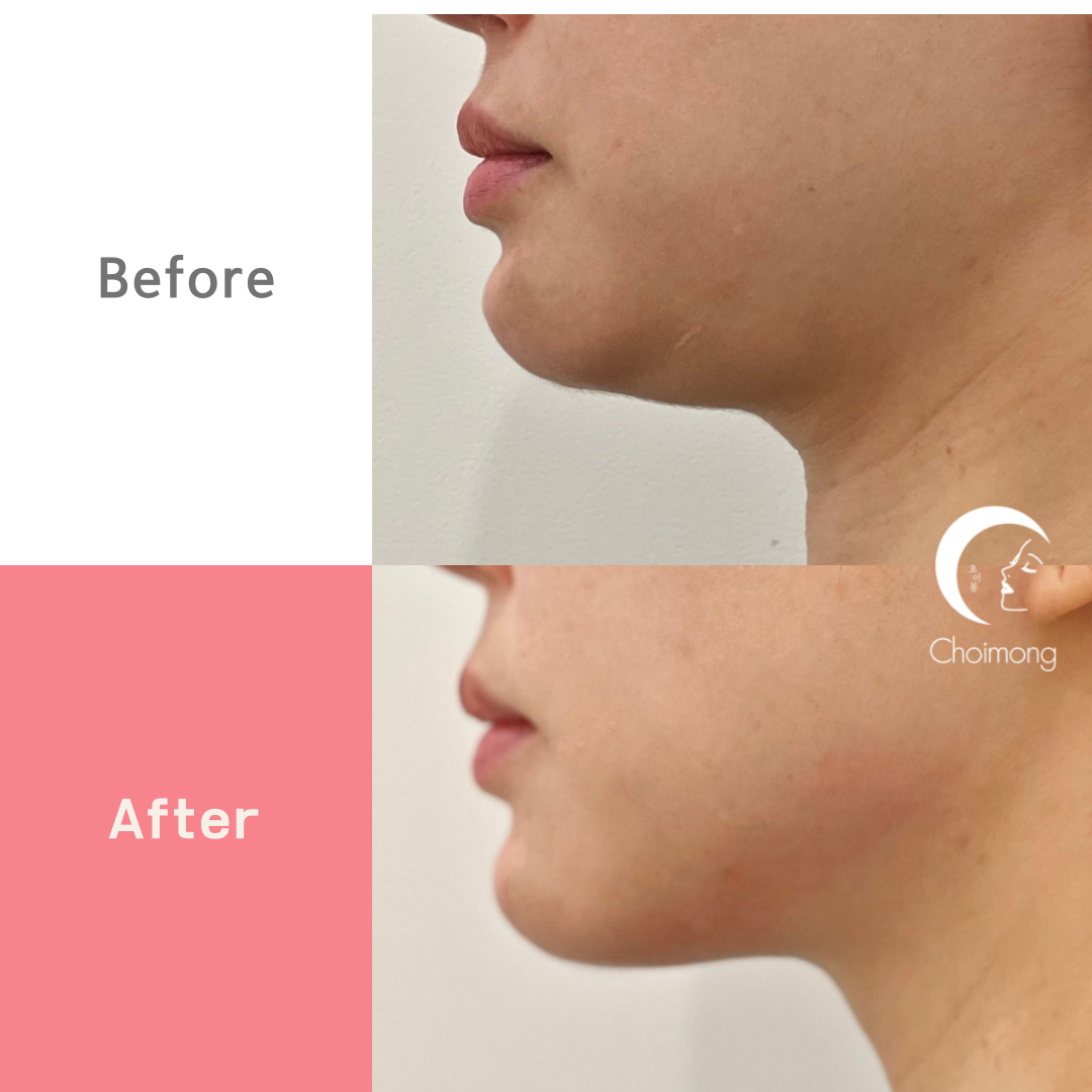 초이몽에스테틱 대표 이미지