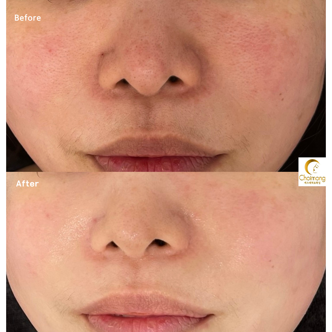 초이몽에스테틱 대표 이미지