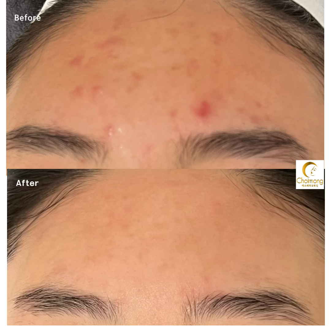 초이몽에스테틱 대표 이미지