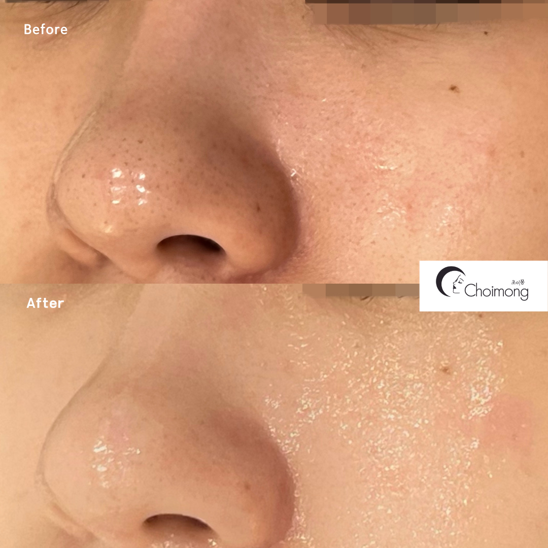 초이몽에스테틱 대표 이미지