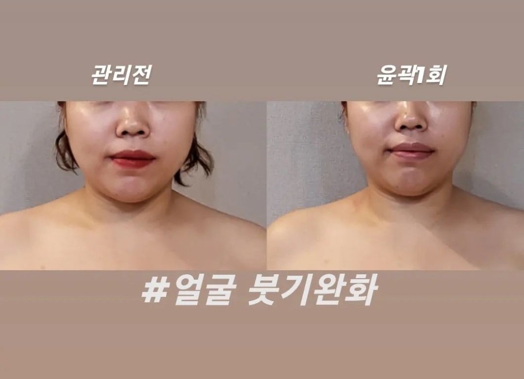 작은얼굴바른체형