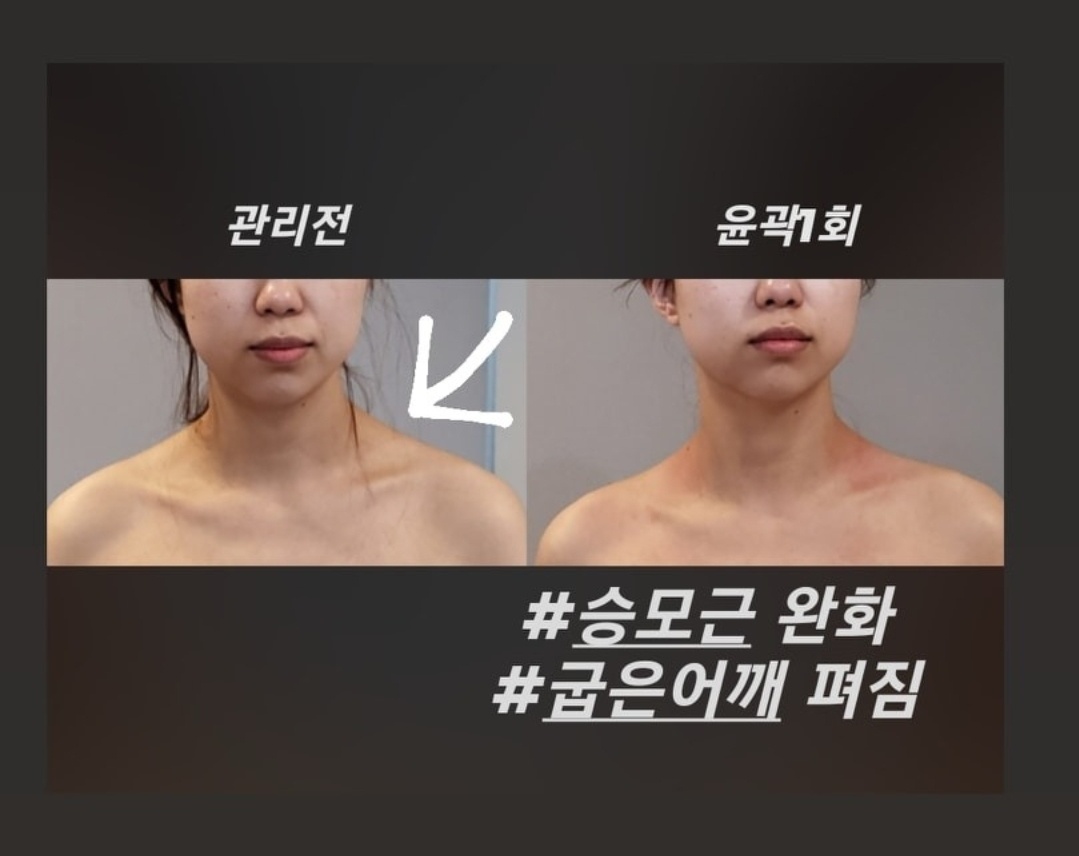 작은얼굴바른체형