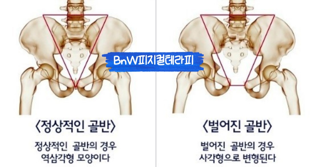 BnW피지컬테라피