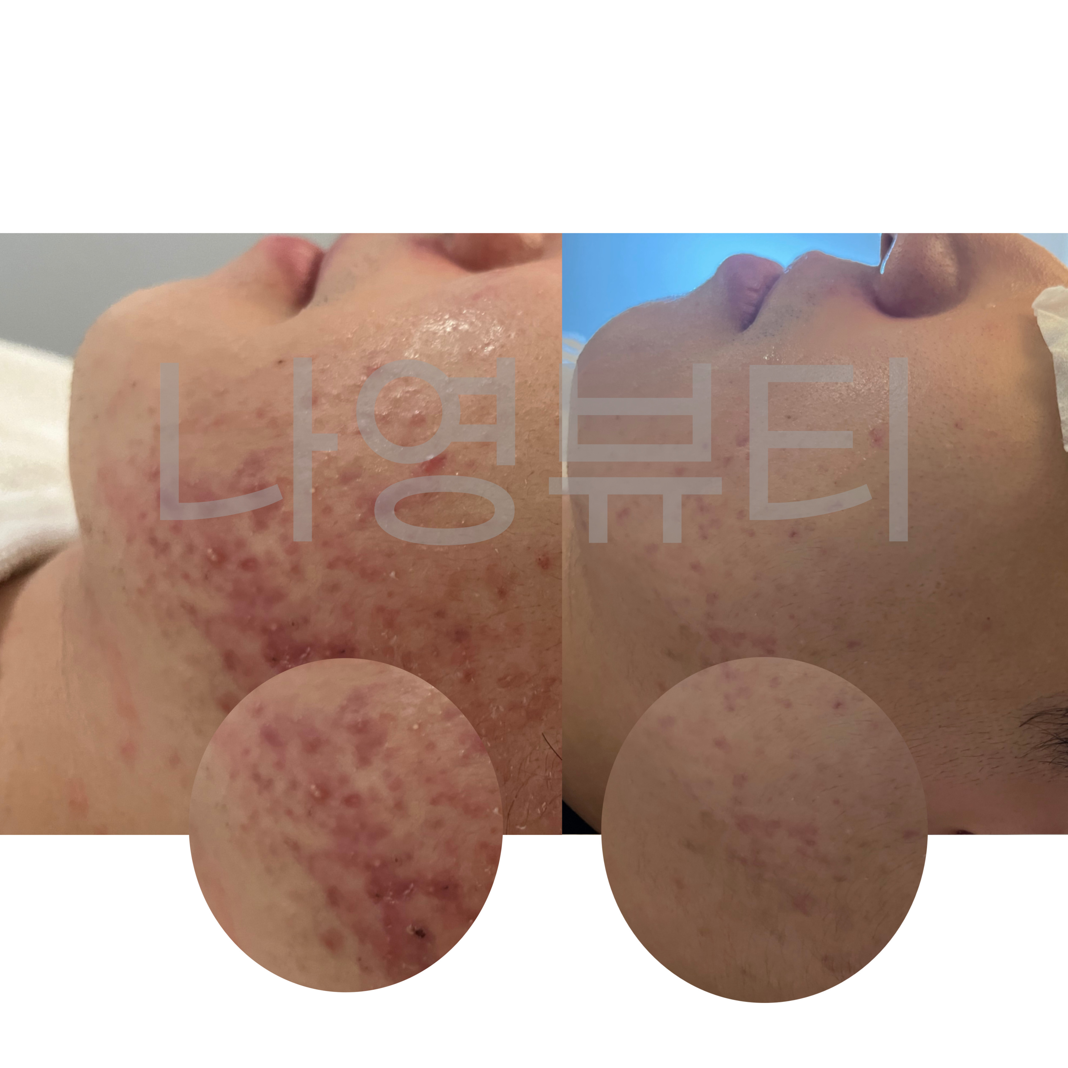 나영뷰티센터