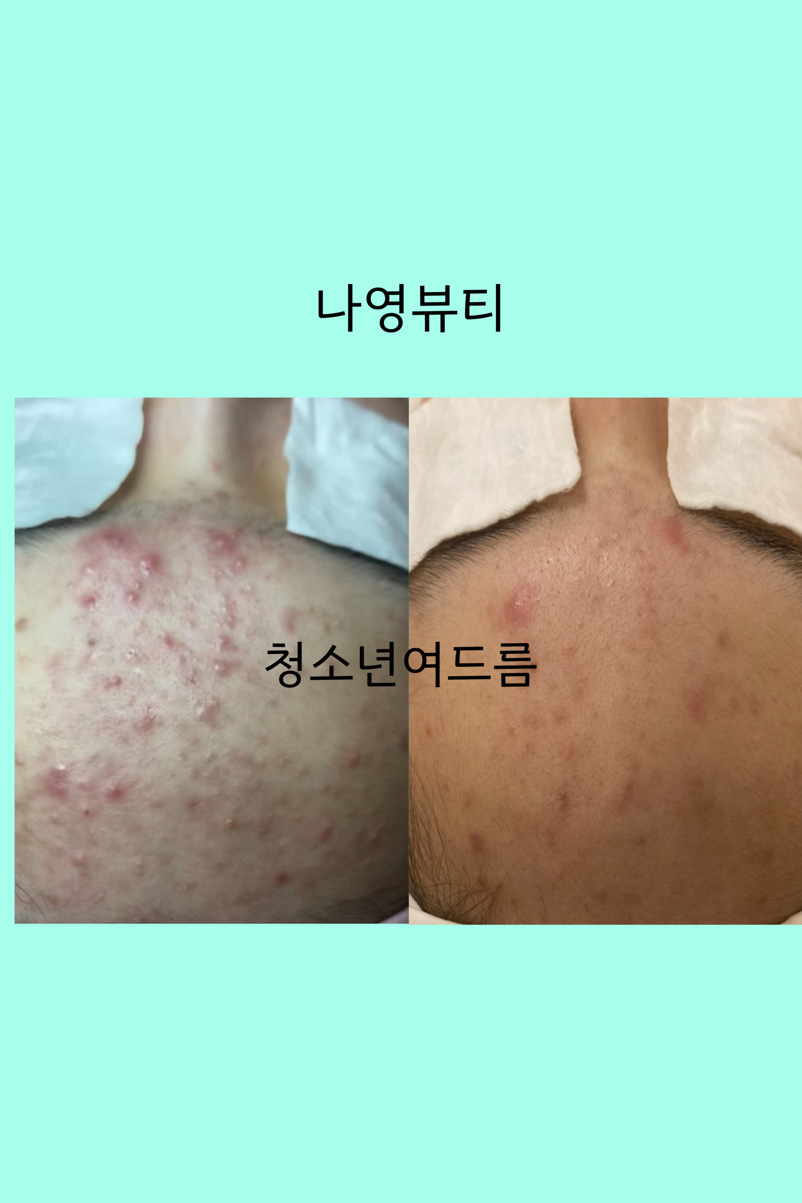 나영뷰티센터