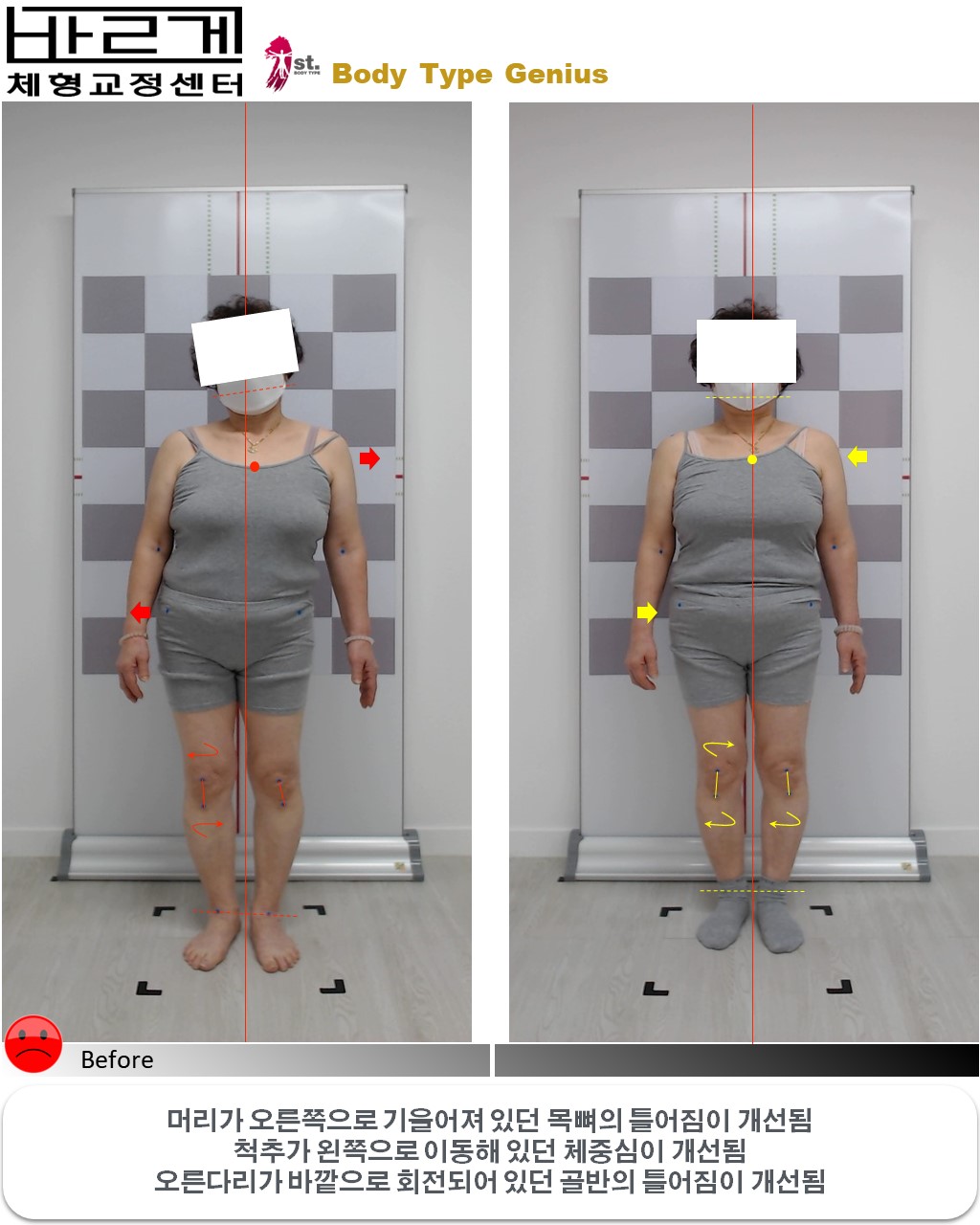 바르게 체형교정운동센터 대표 이미지