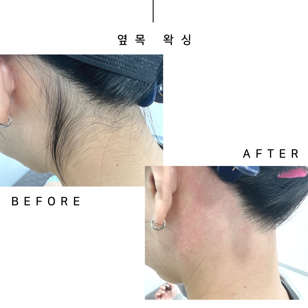뷰티온왁싱 부산동래점