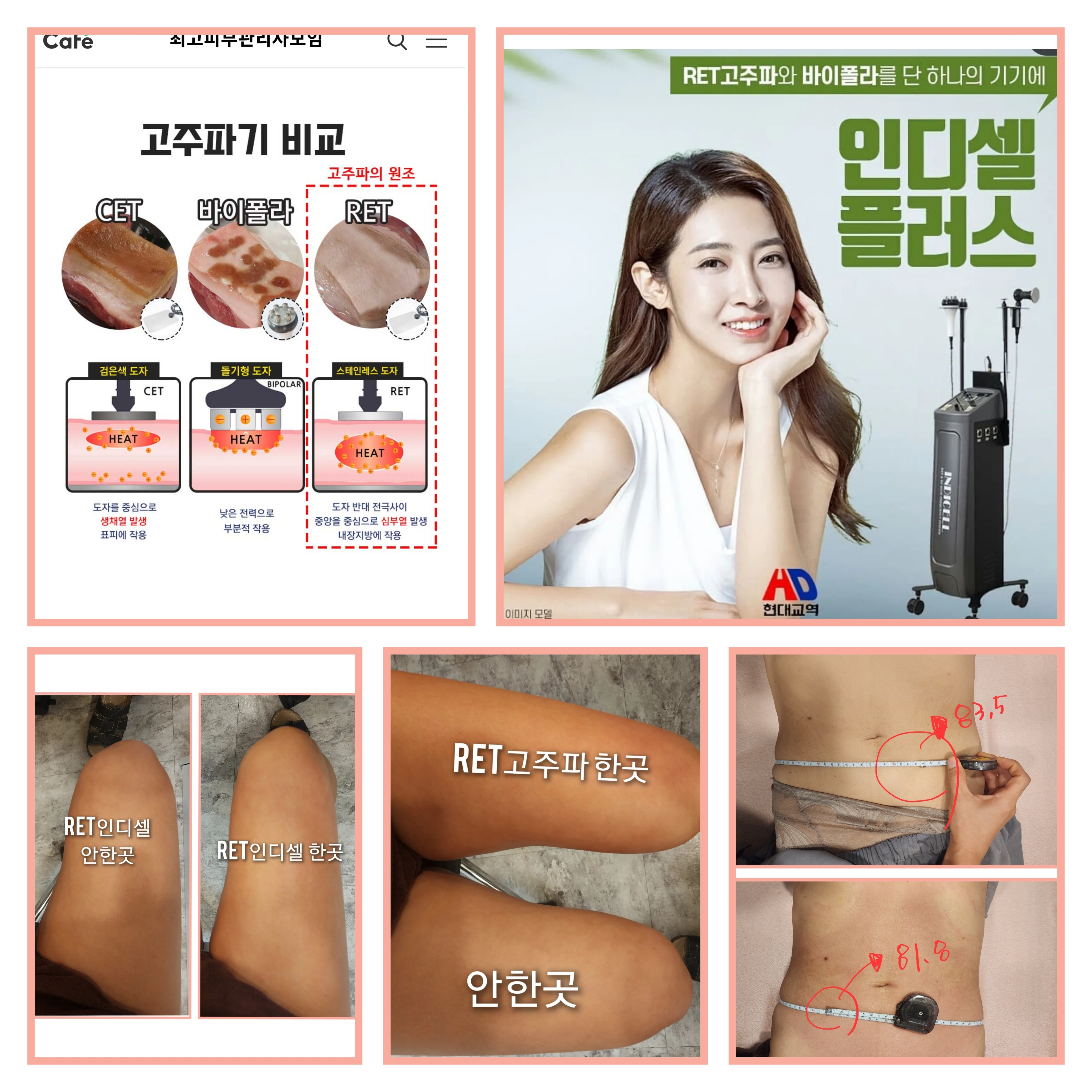크리스탈스킨&바디