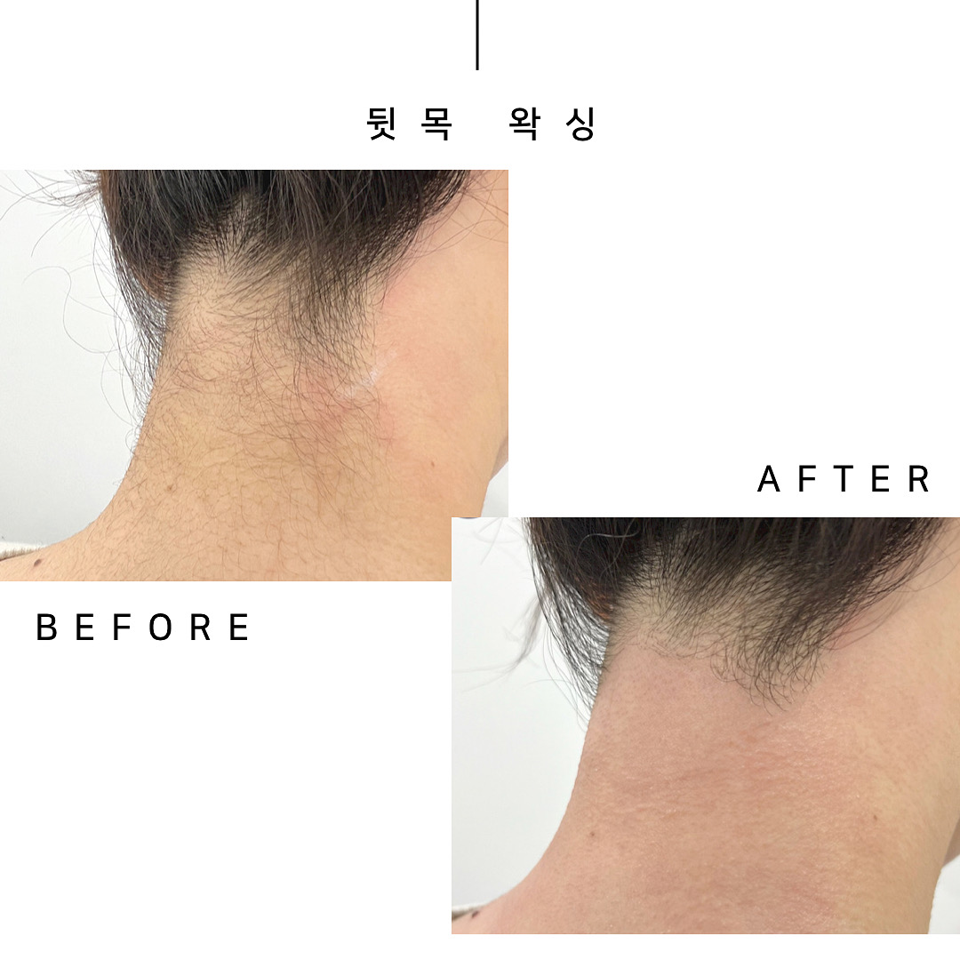 뷰티온왁싱 부산동래점