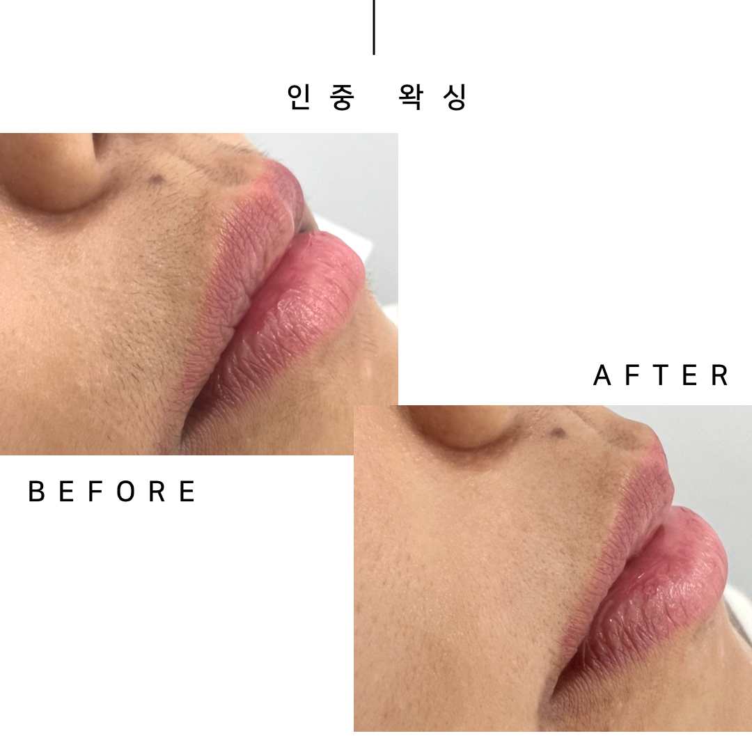 뷰티온왁싱 부산동래점