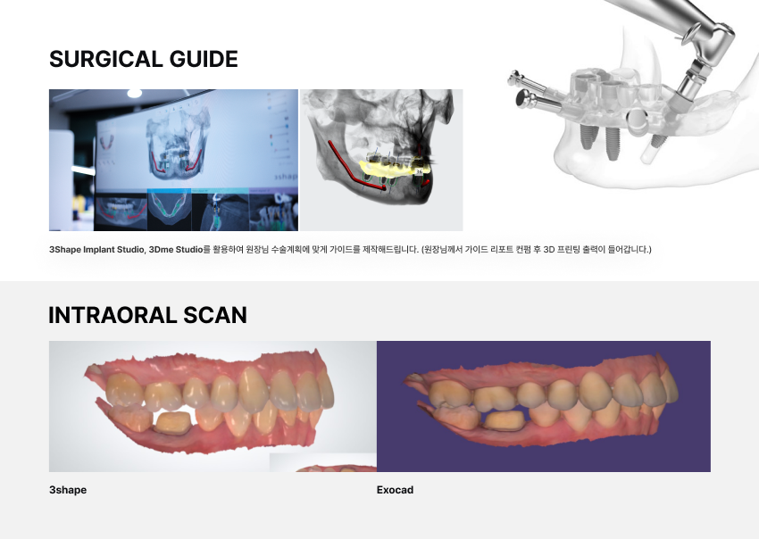 티핏기공소 대표 이미지
