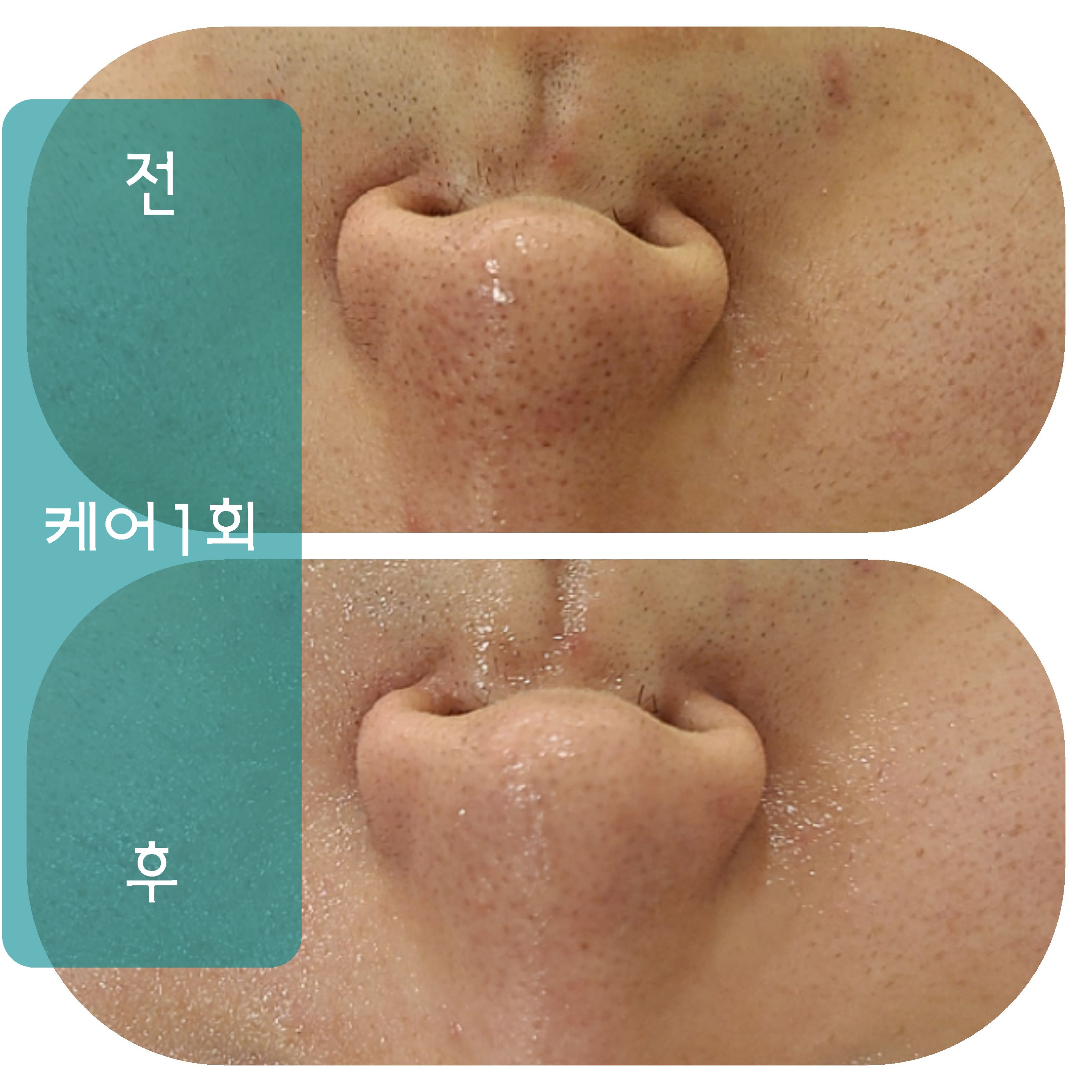 뷰티호텔 진천혁신점