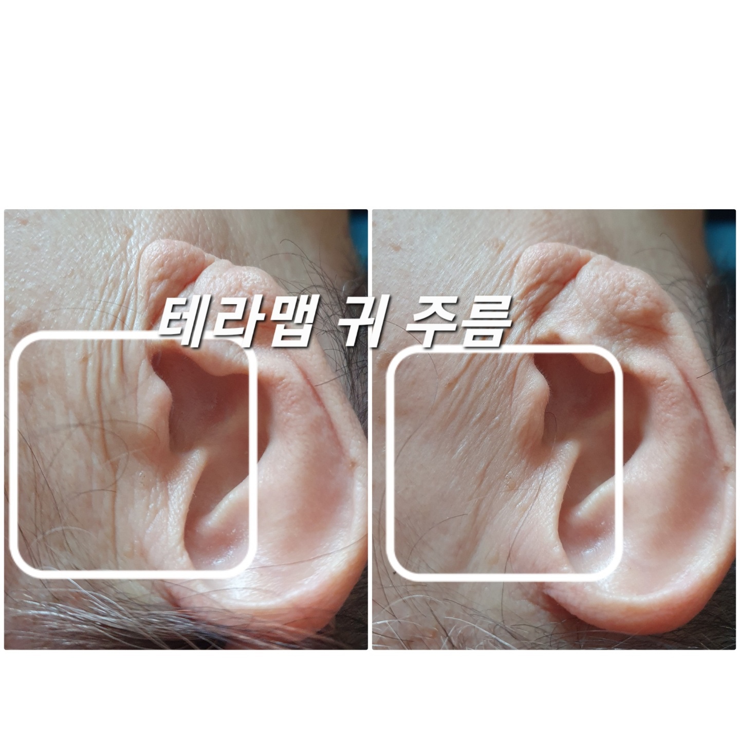 뷰티고울수 photo 2