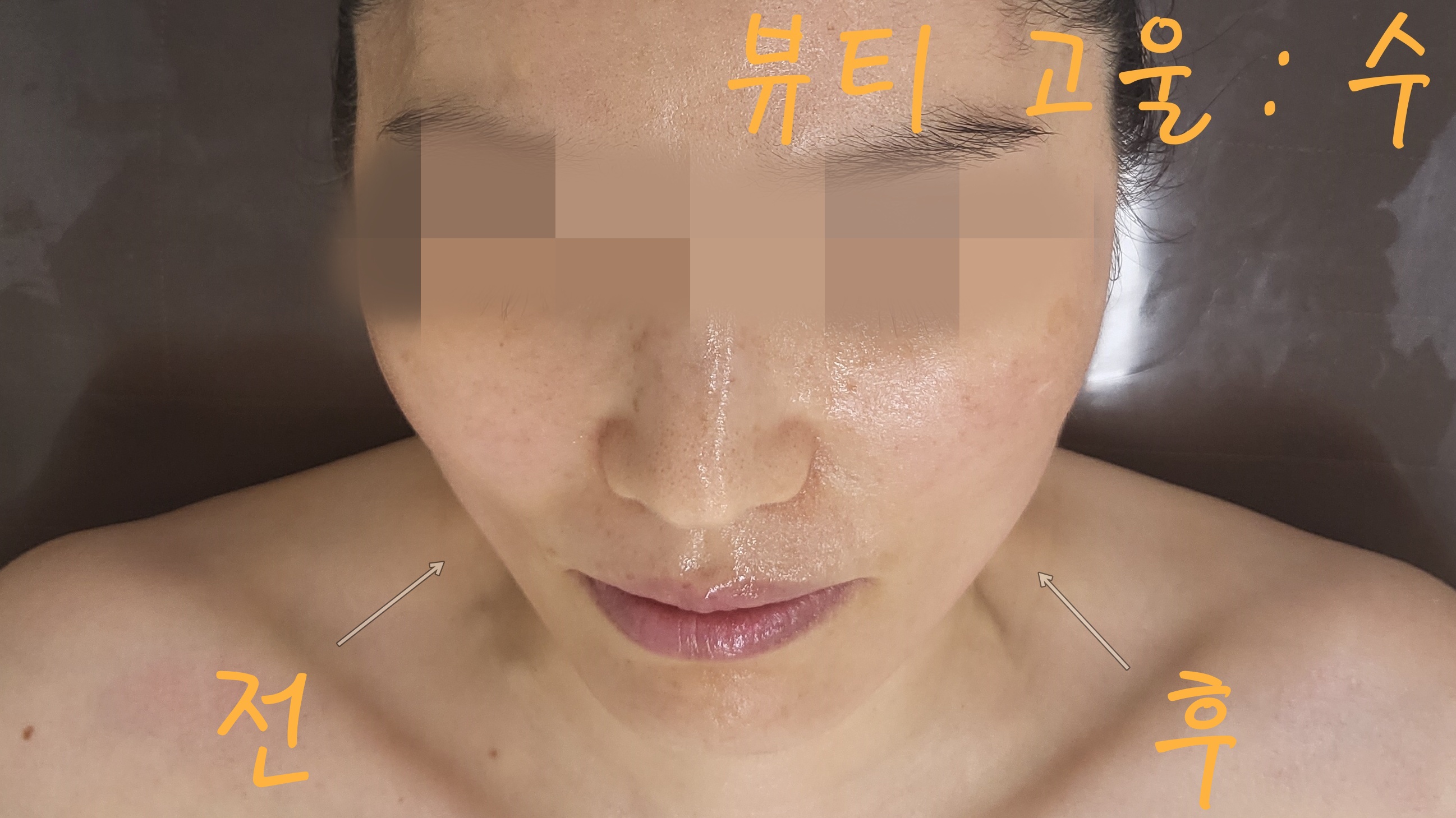 뷰티고울수 photo 7