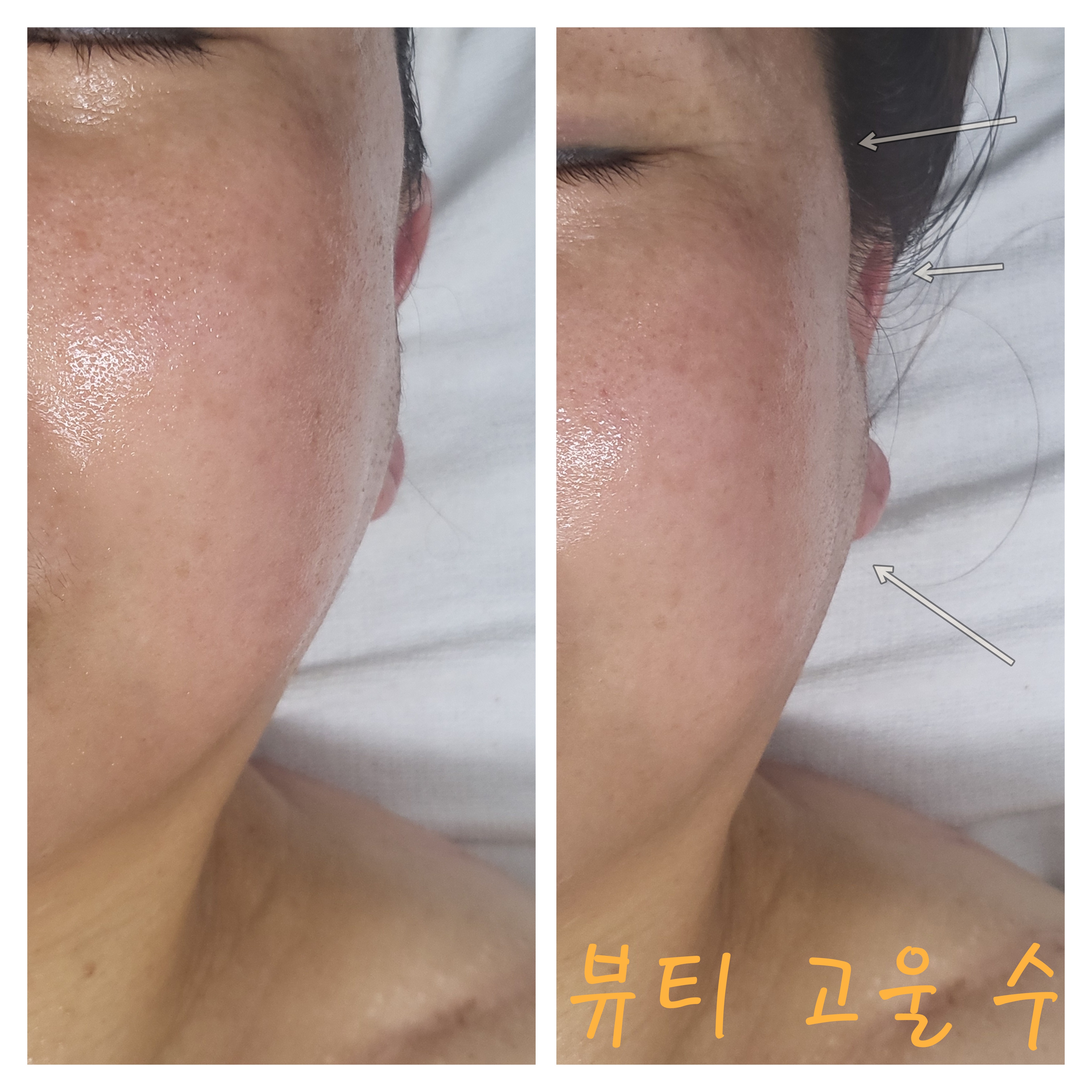 뷰티고울수 photo 10