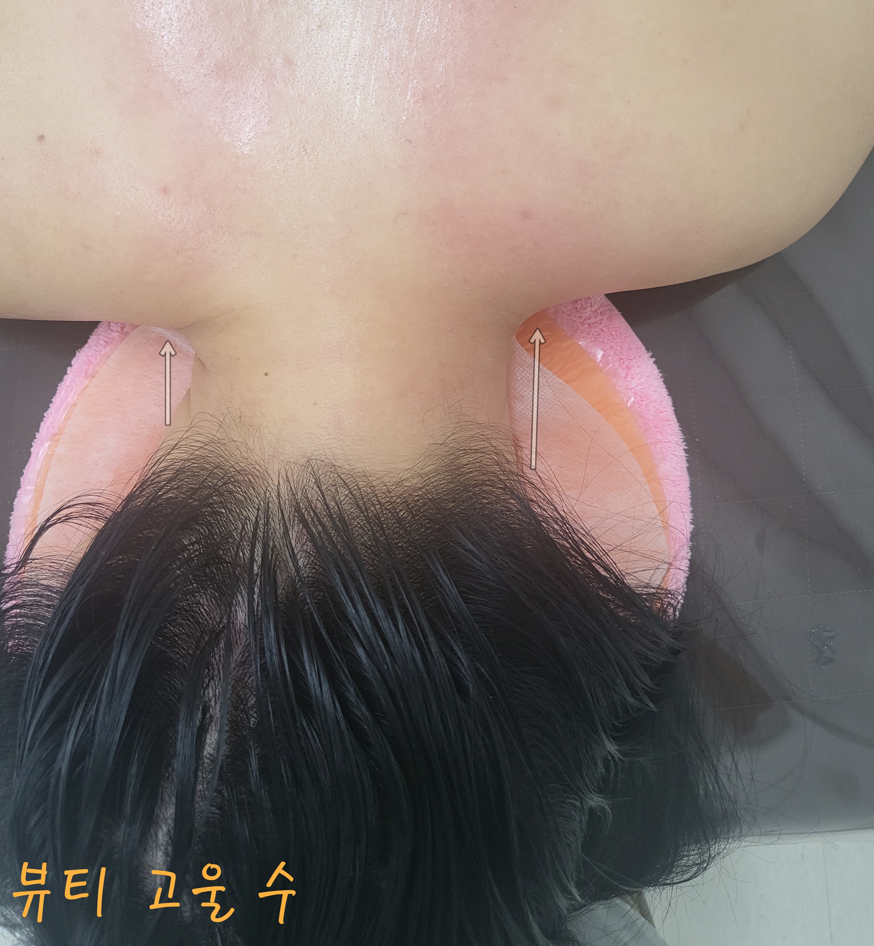 뷰티고울수 photo 9