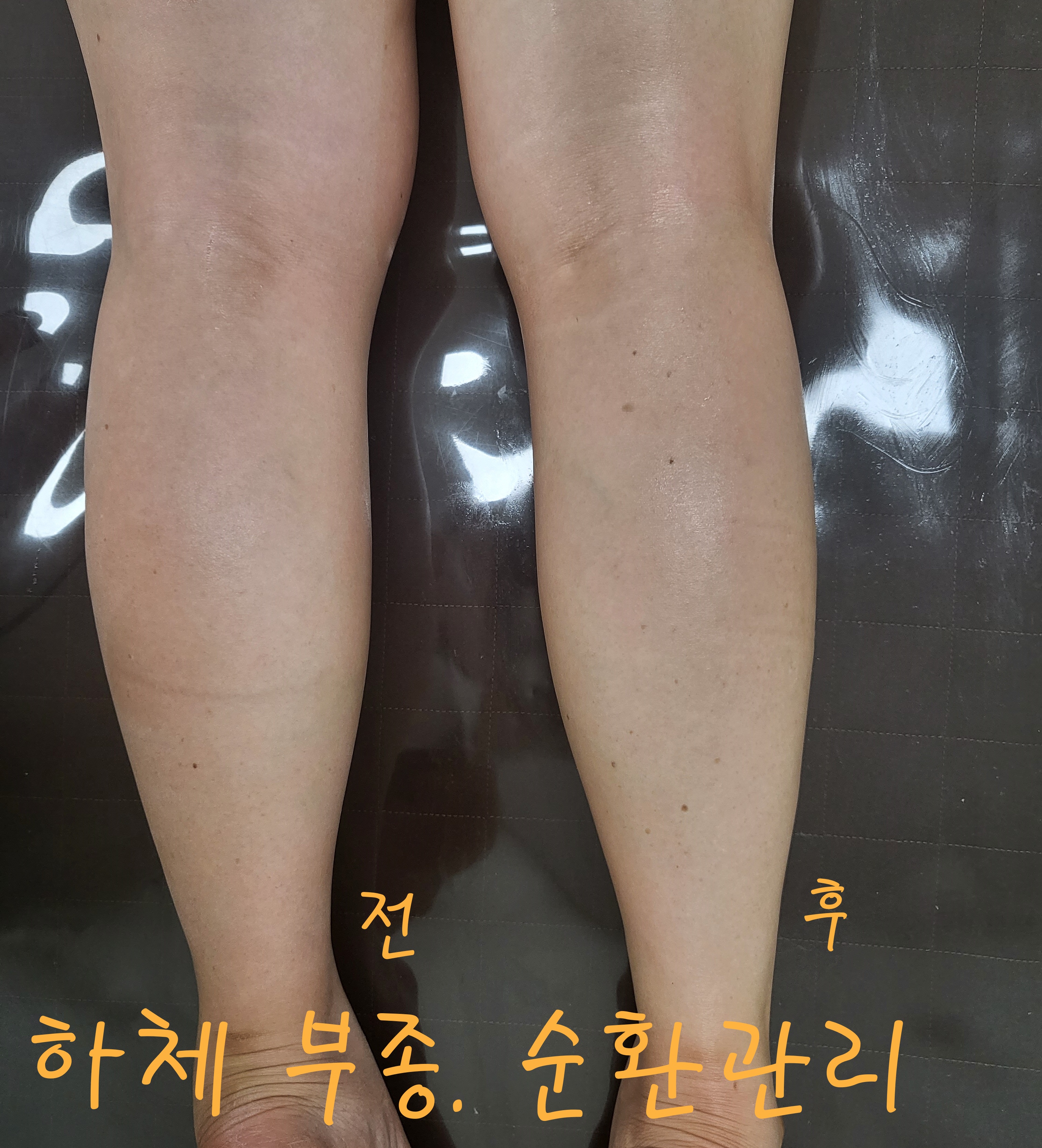 뷰티고울수 photo 8