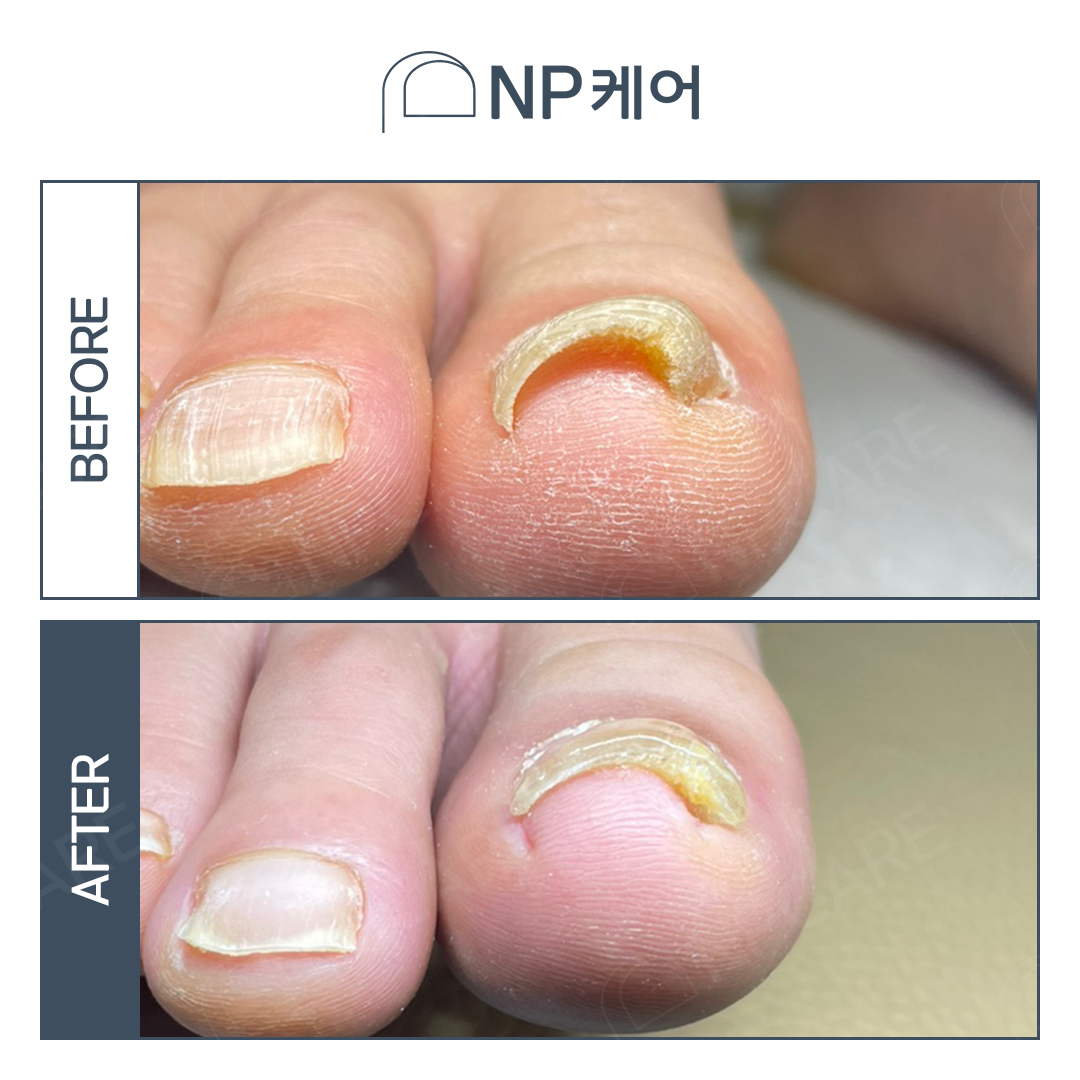 엔피케어 대표 이미지