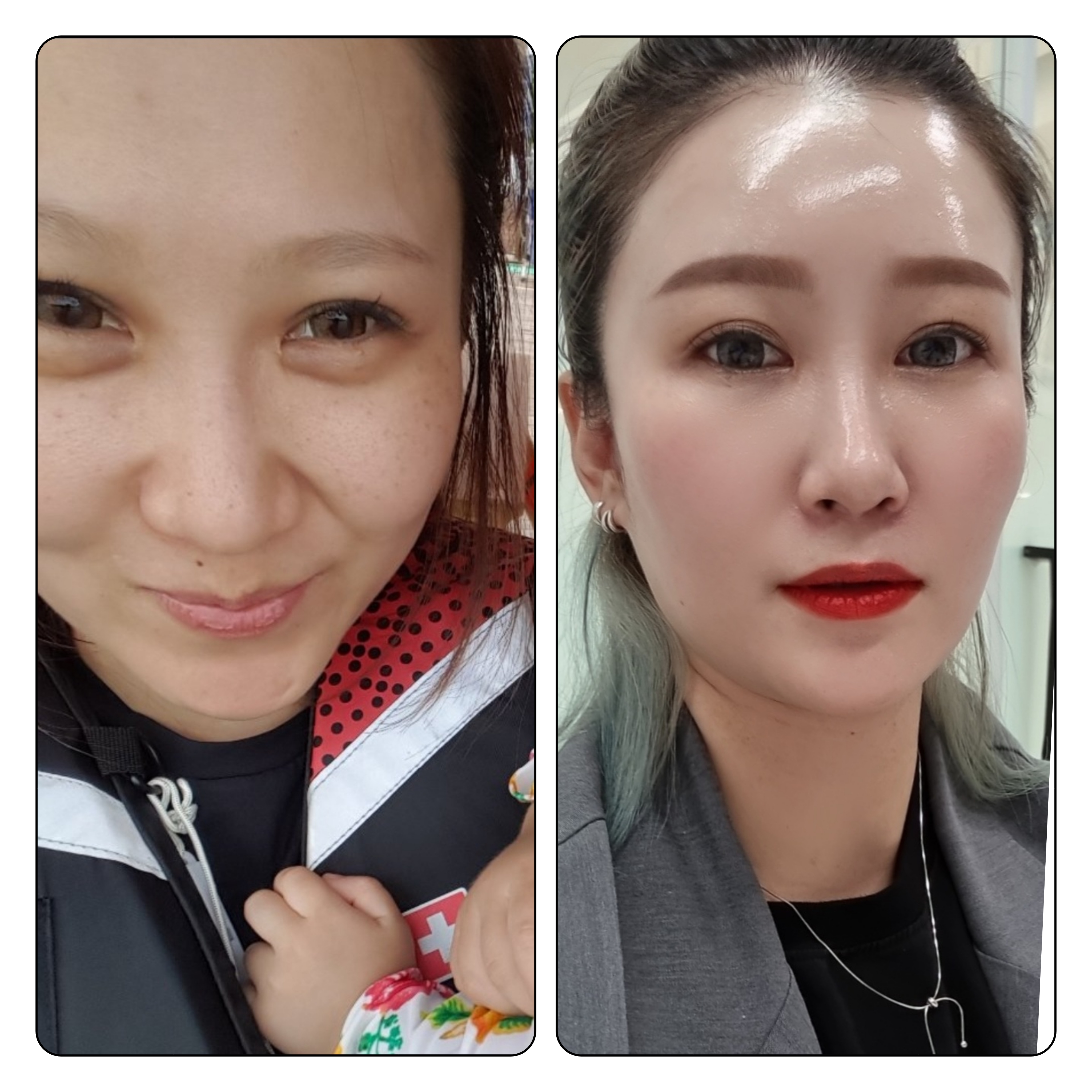 지안뷰티 인셀덤