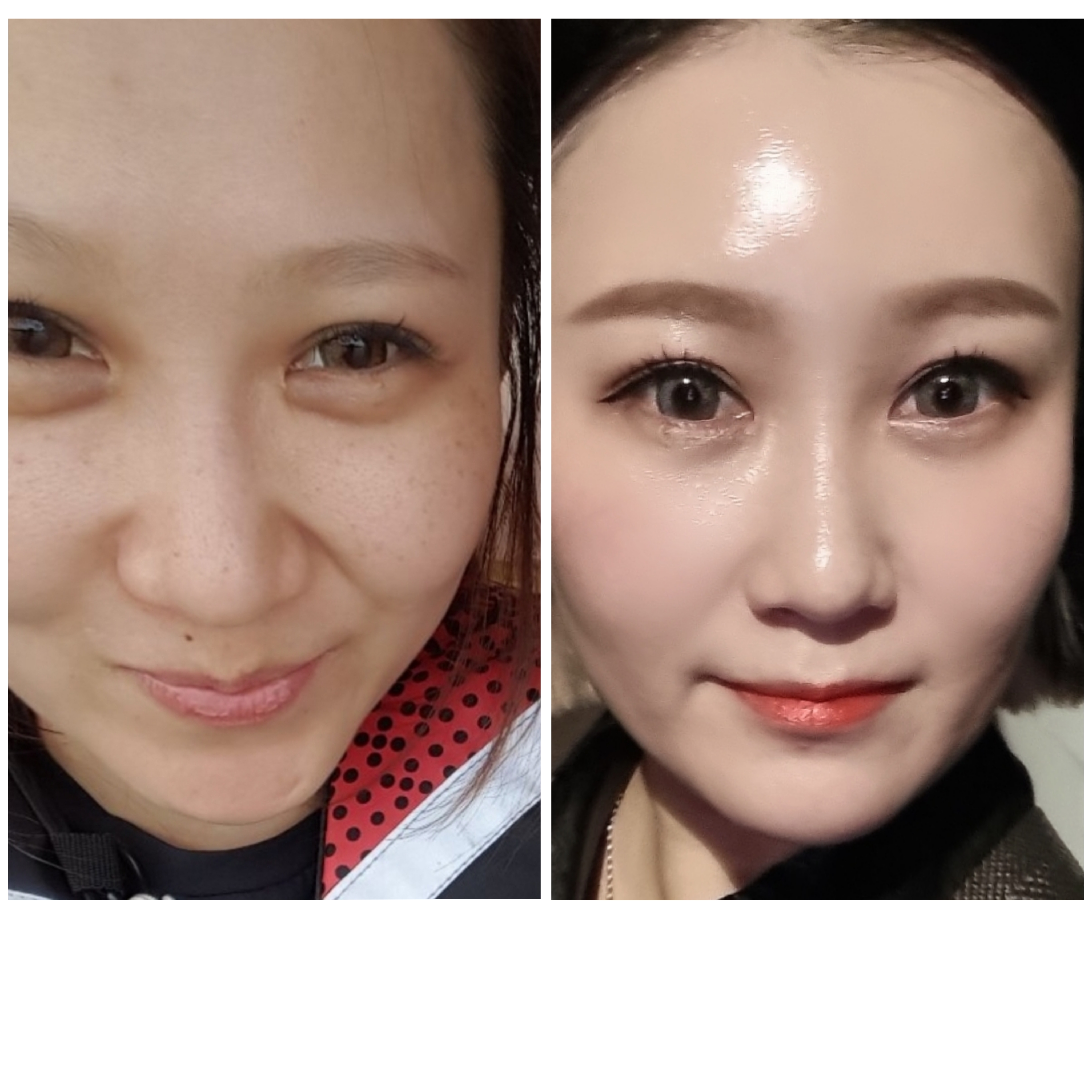 지안뷰티 인셀덤