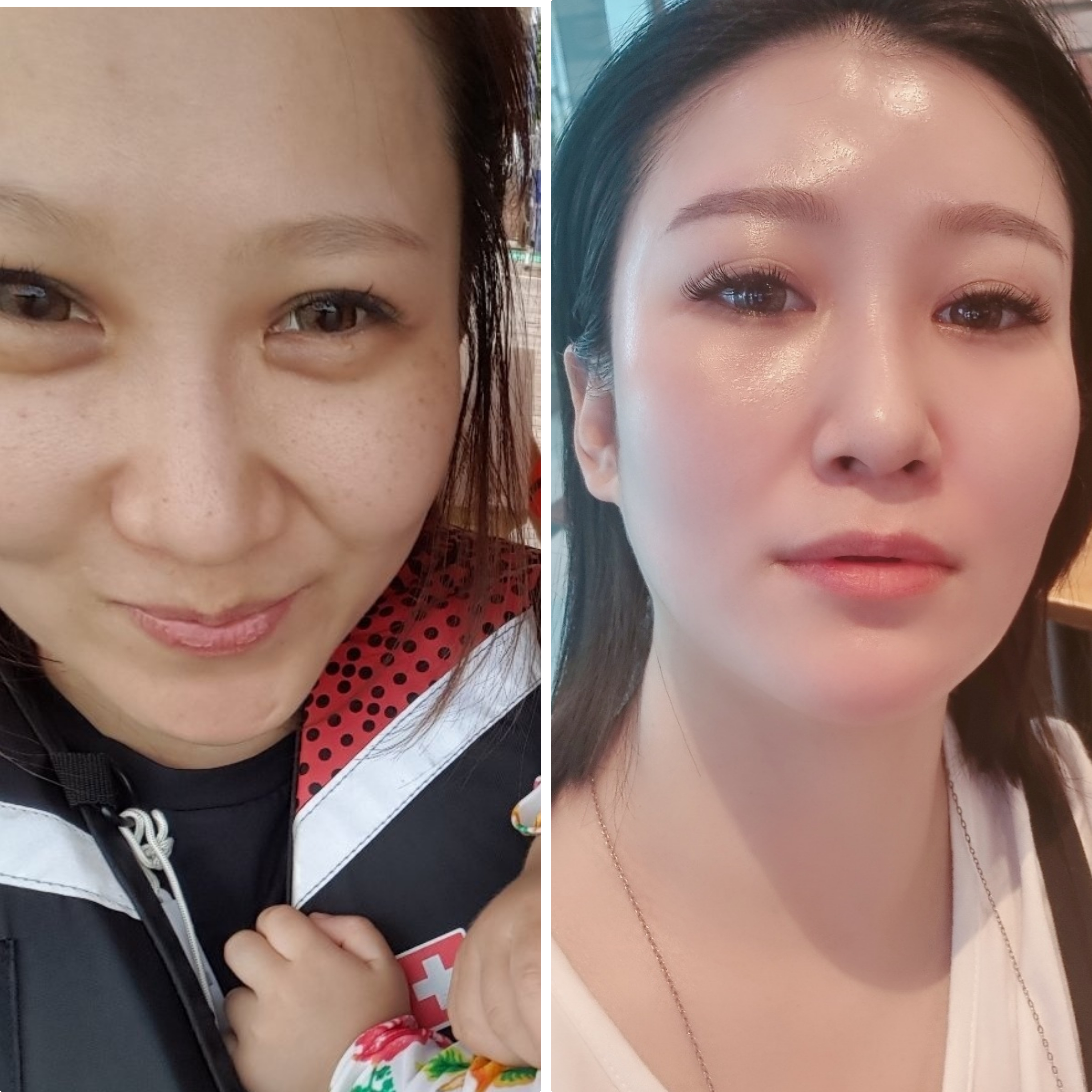 지안뷰티 인셀덤