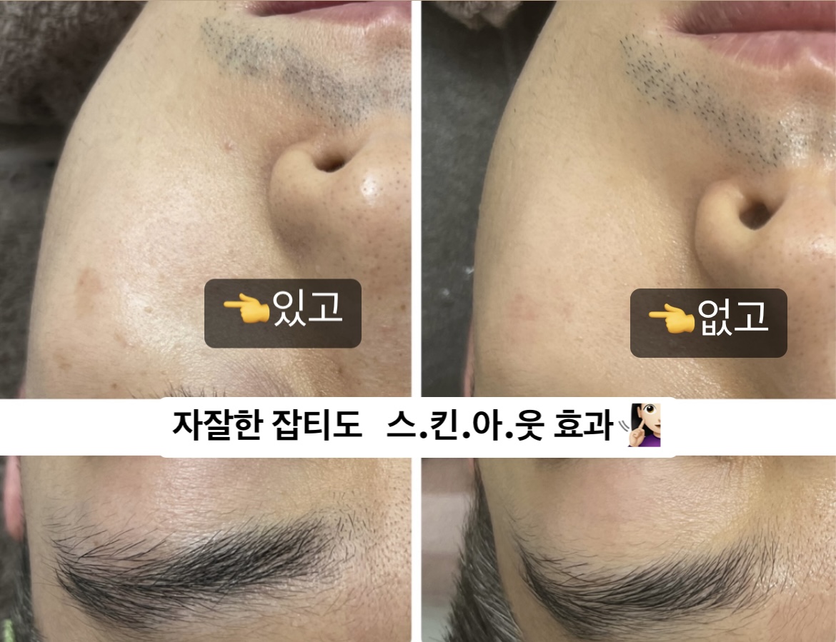 스킨아웃 평택안중본점