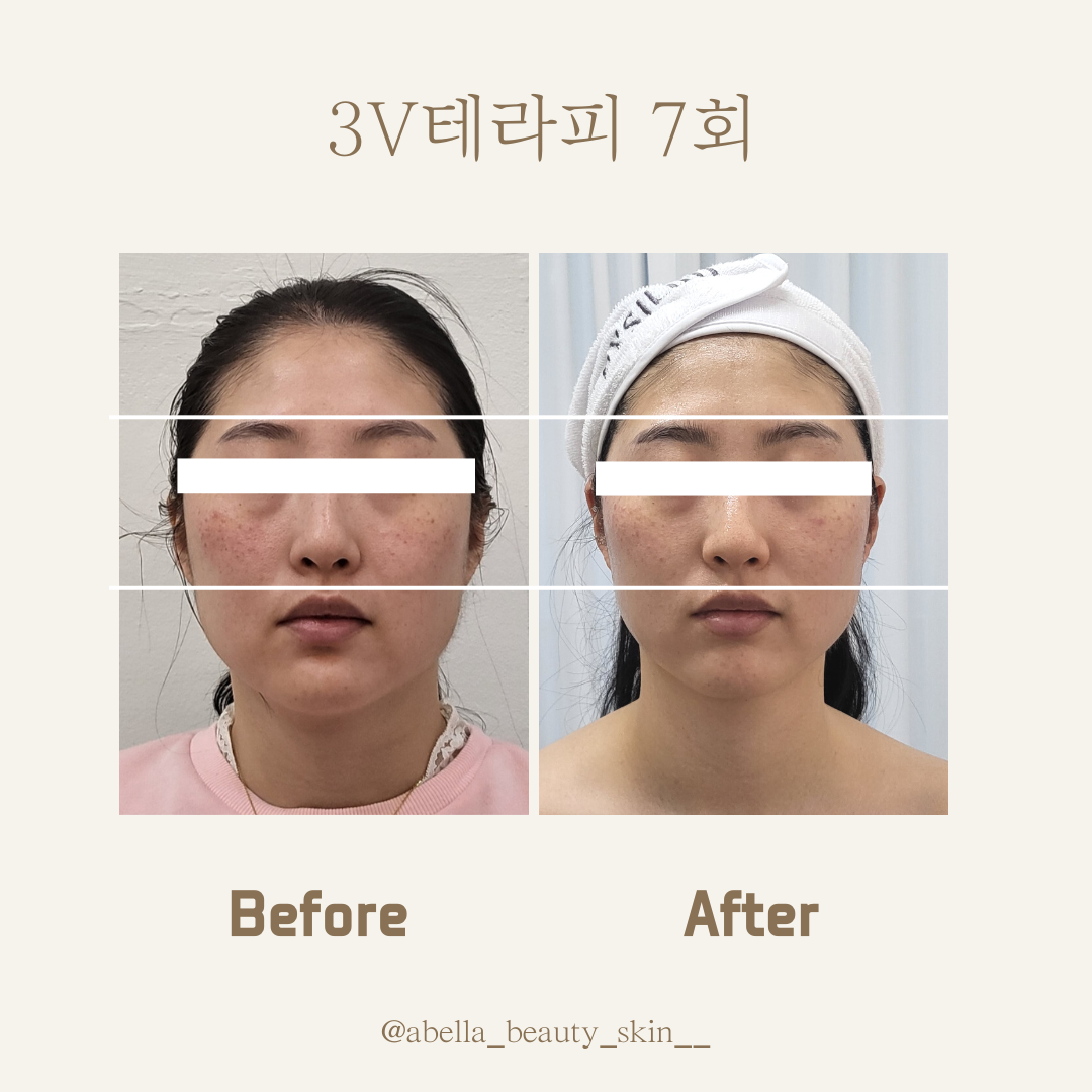 아벨라뷰티 대전본점