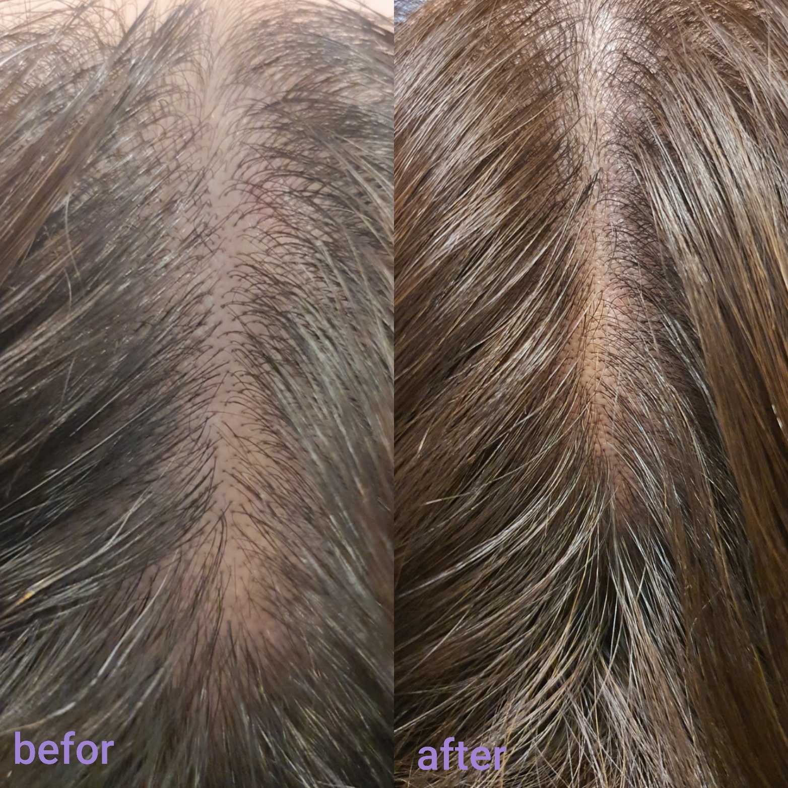 현아에스테틱 대표 이미지