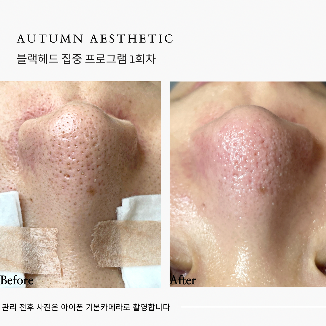 어텀에스테틱 안양범계점 대표 이미지