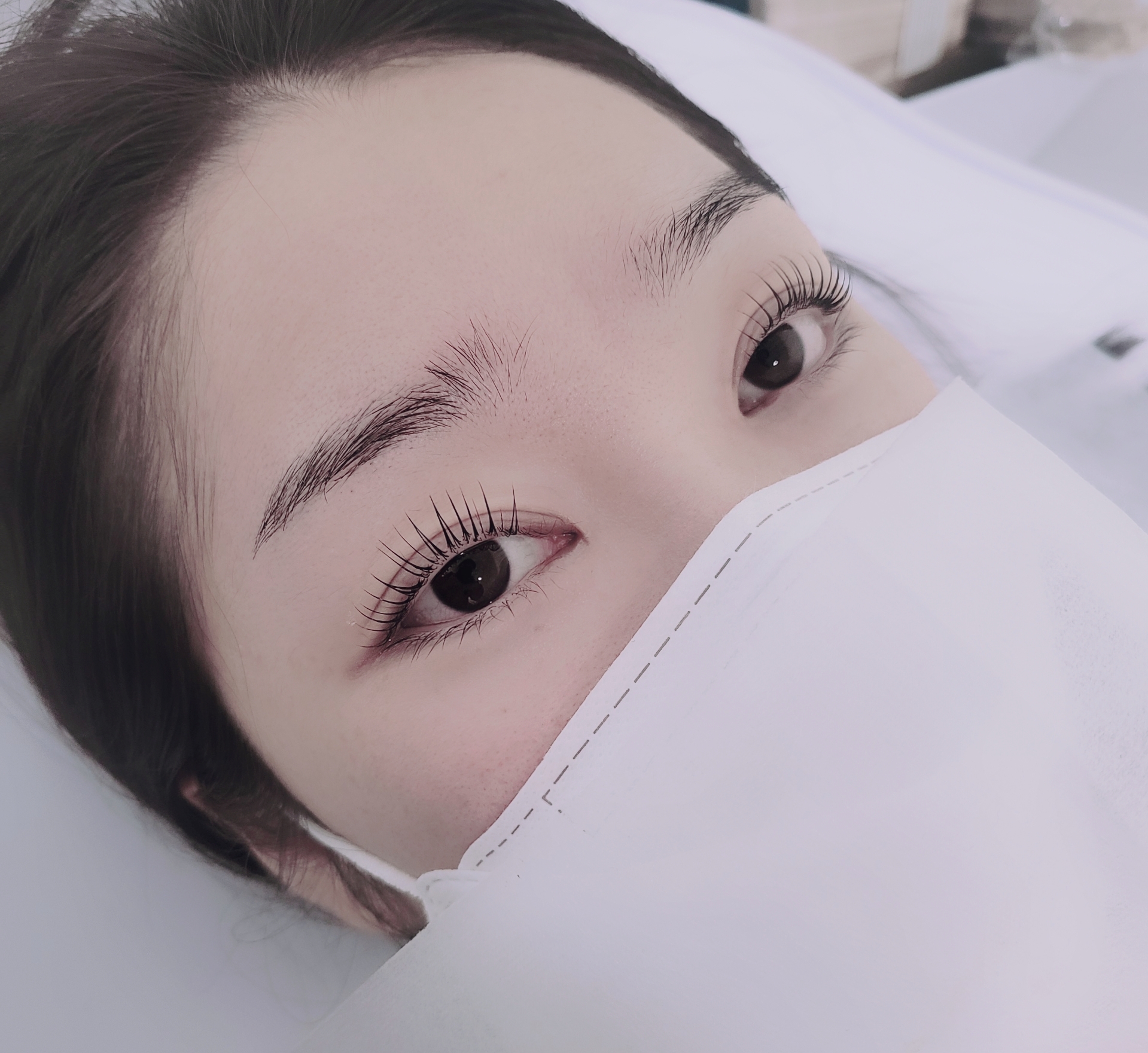 컬리블리 시술 이미지