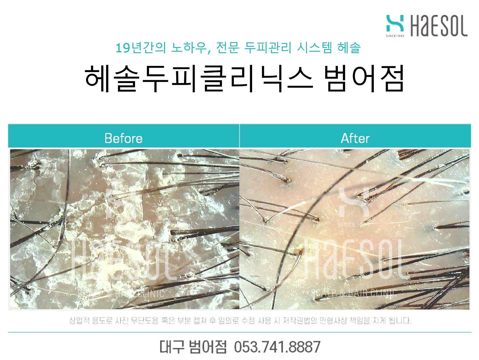 헤솔두피클리닉스 대구범어점