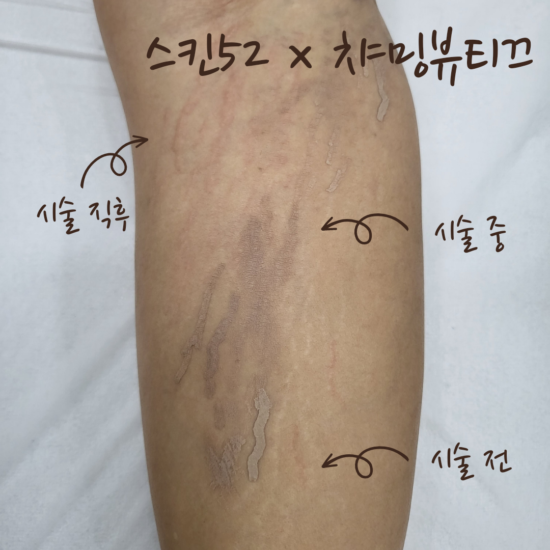 챠밍뷰티끄