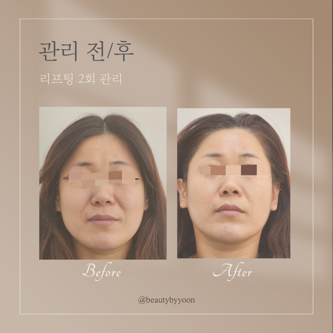 뷰티바이윤 photo 2