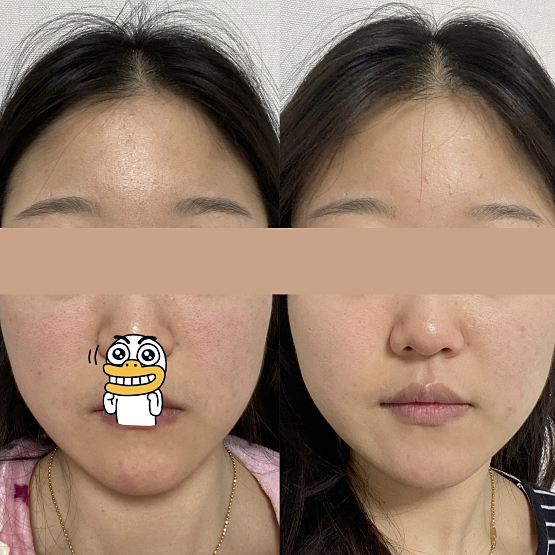 하베레피부전문센터