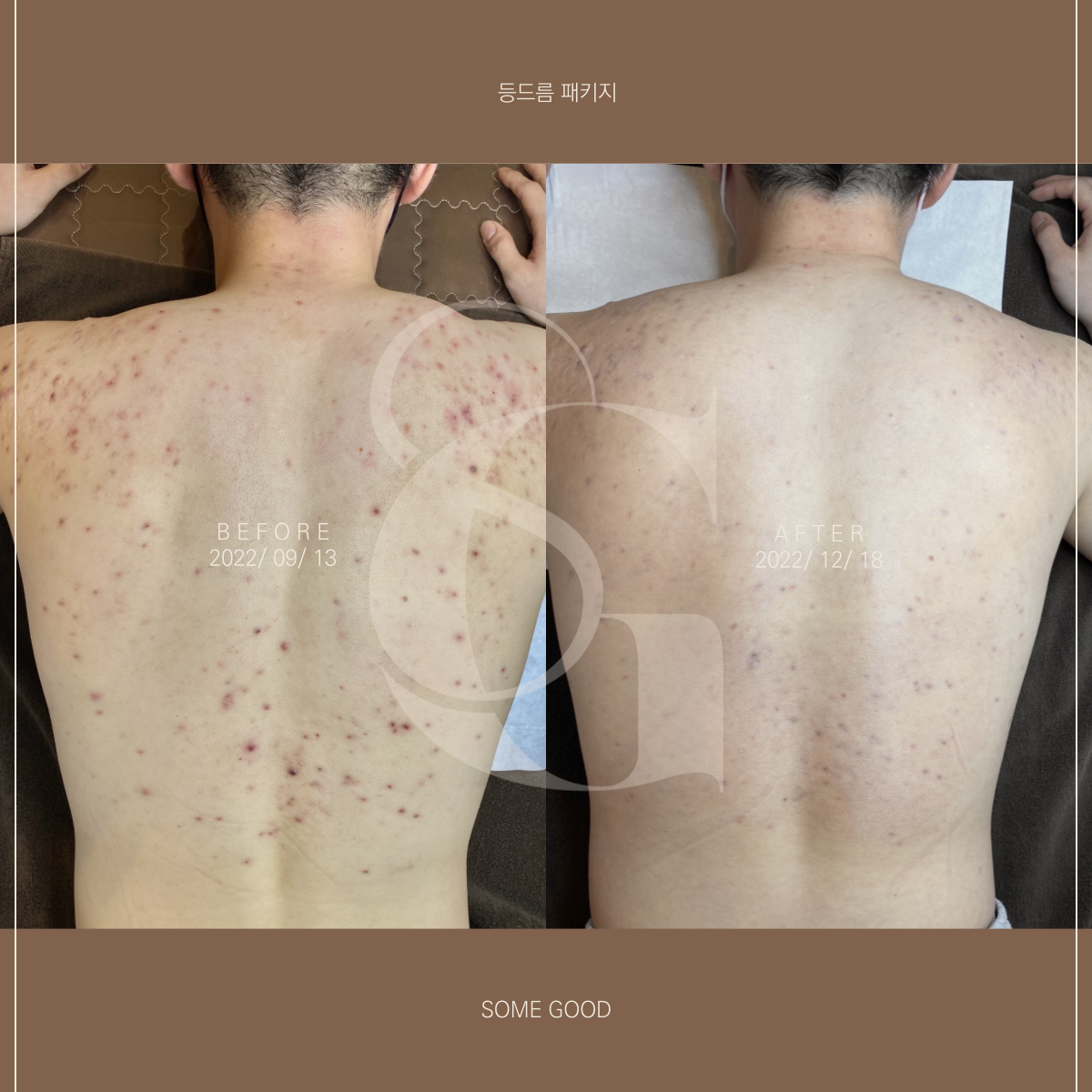 썸굿 대표 이미지