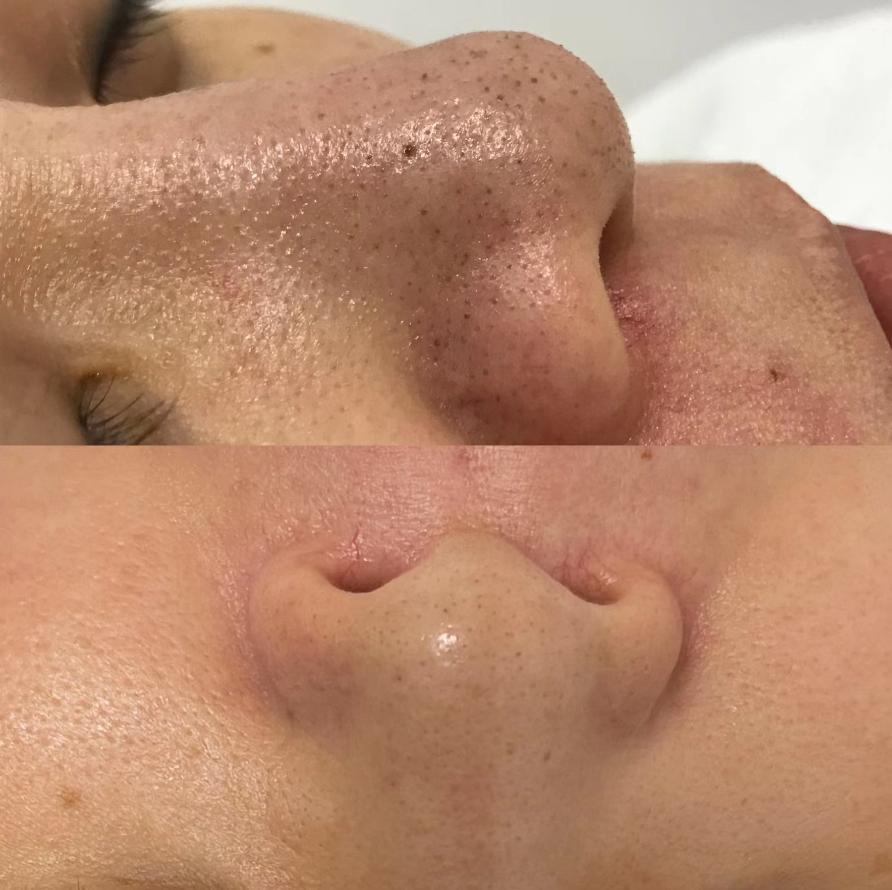 초선 수기테라피 photo 10
