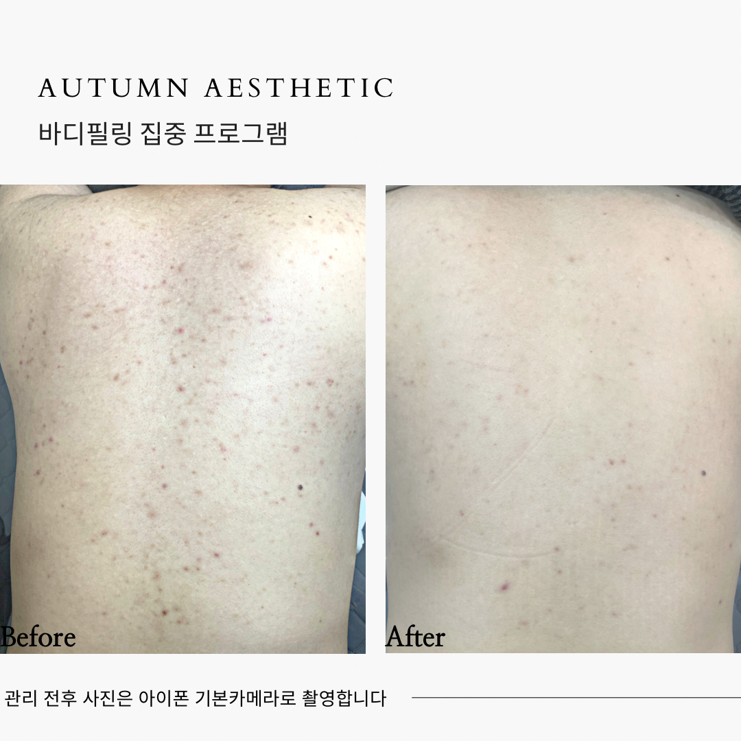 어텀에스테틱 안양본점