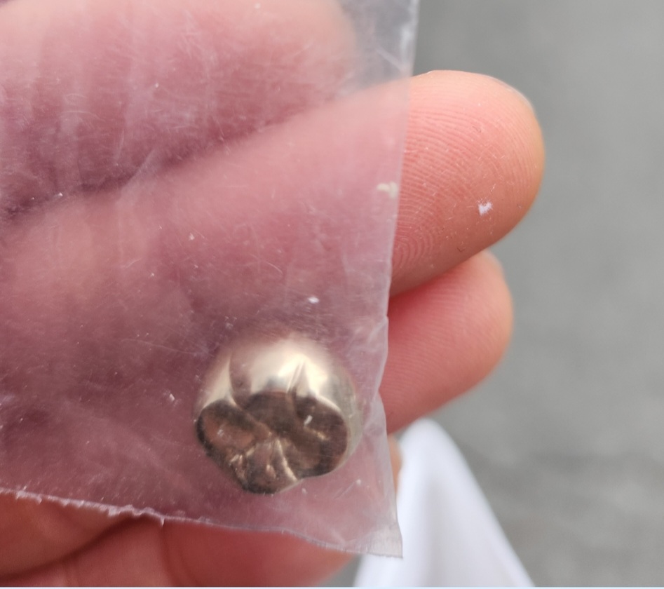 투윈 금니거래소