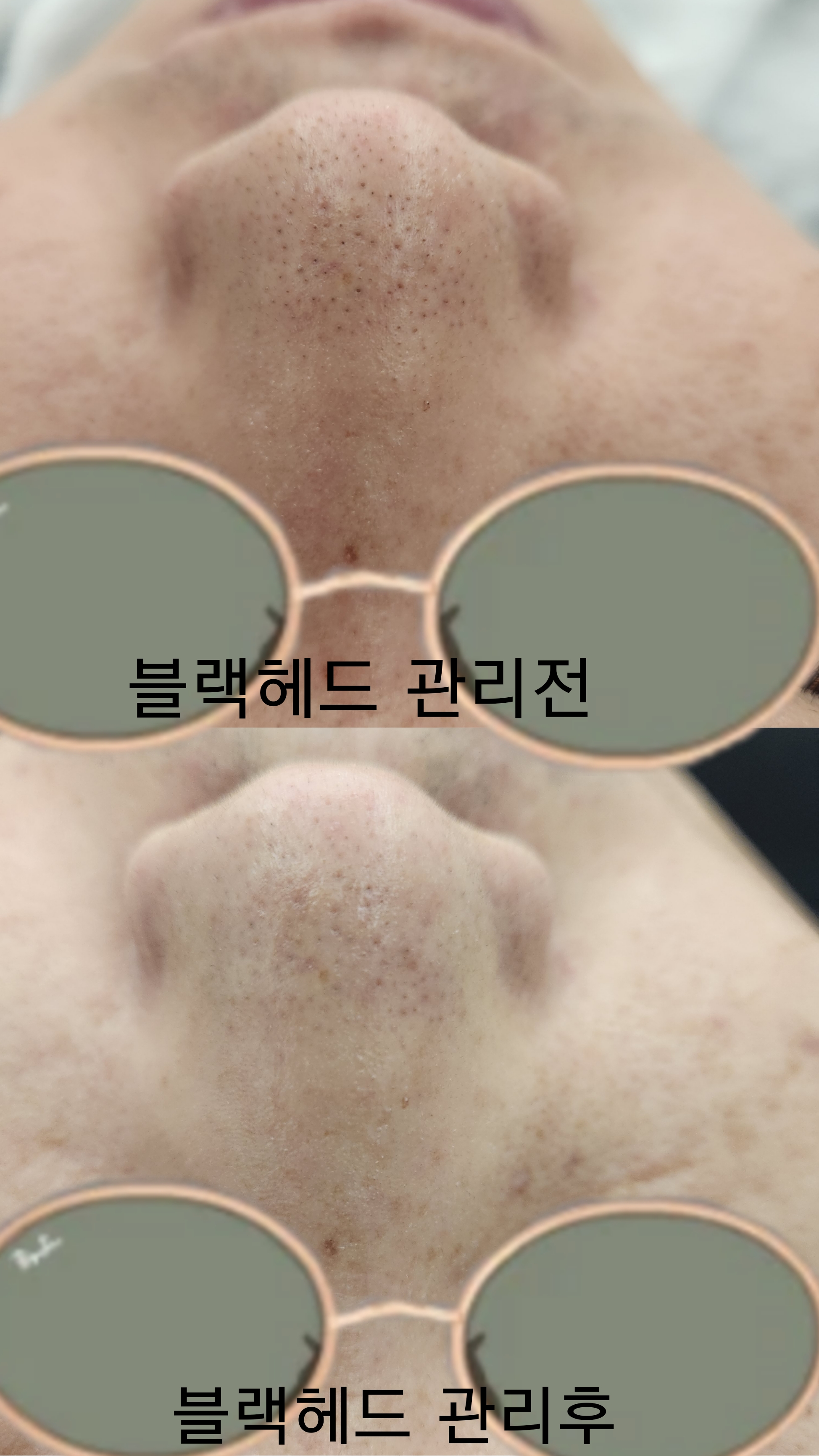 정설에스테틱 피부관리 청주산남동점