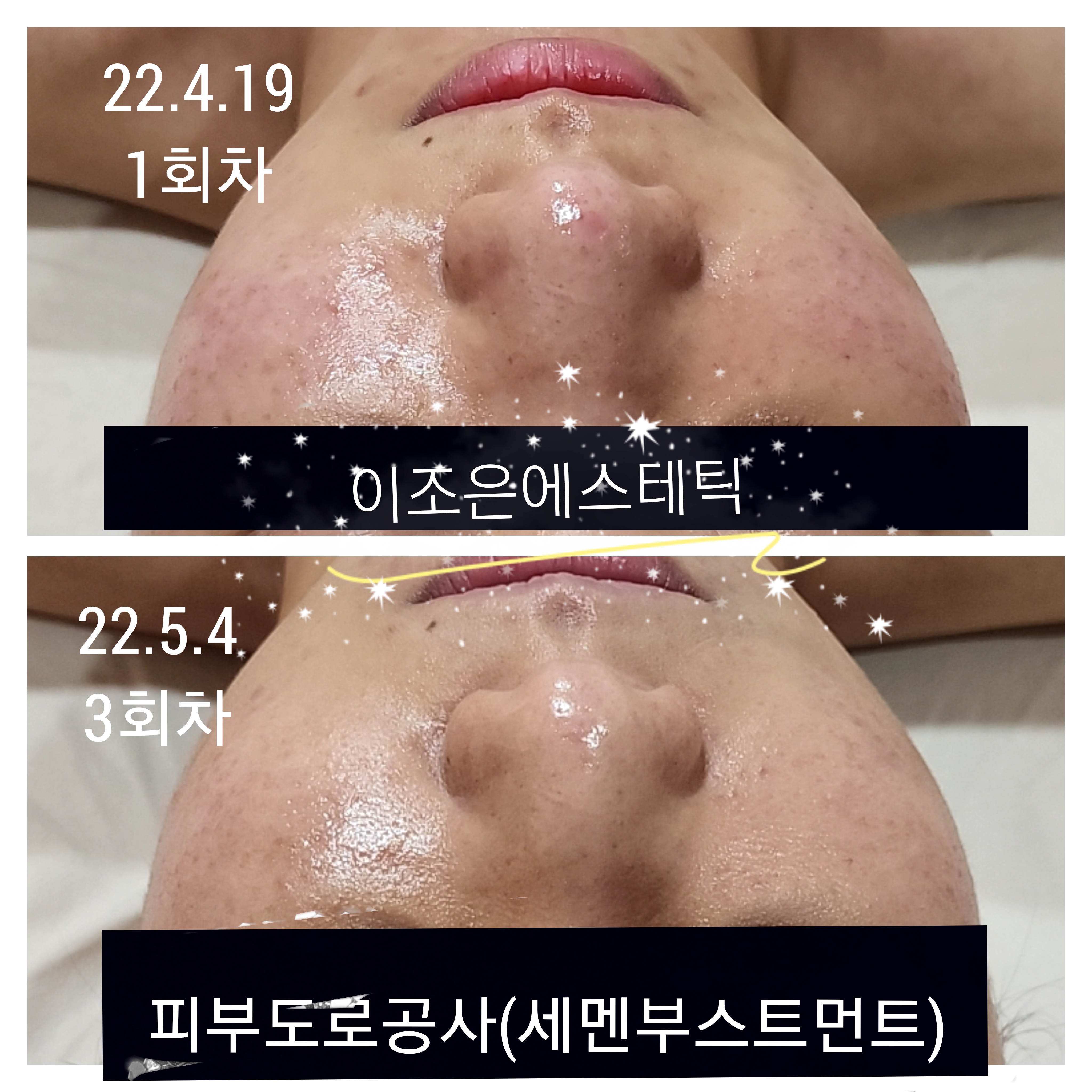 이조은에스테틱 진주혁신점