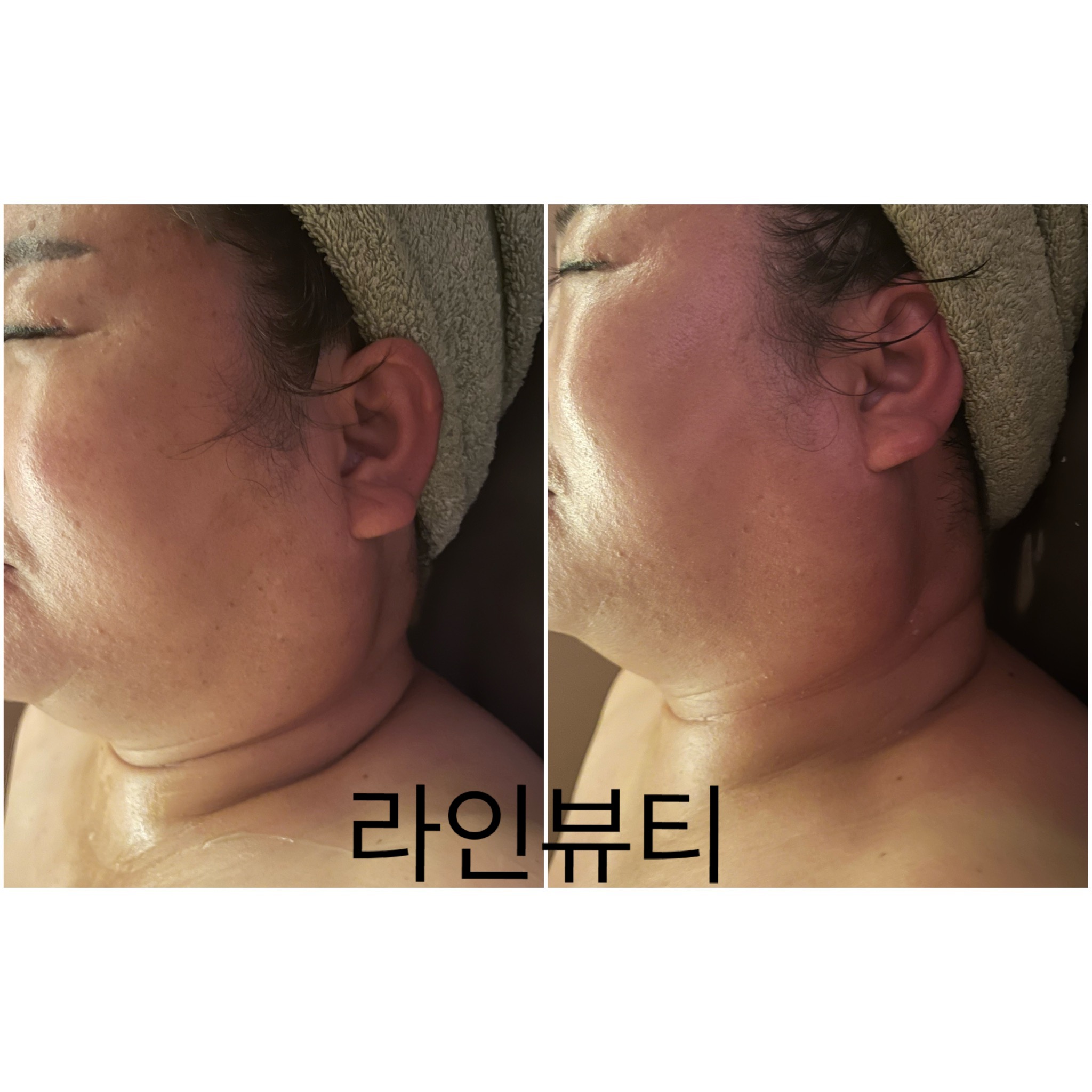 라인뷰티에스테틱